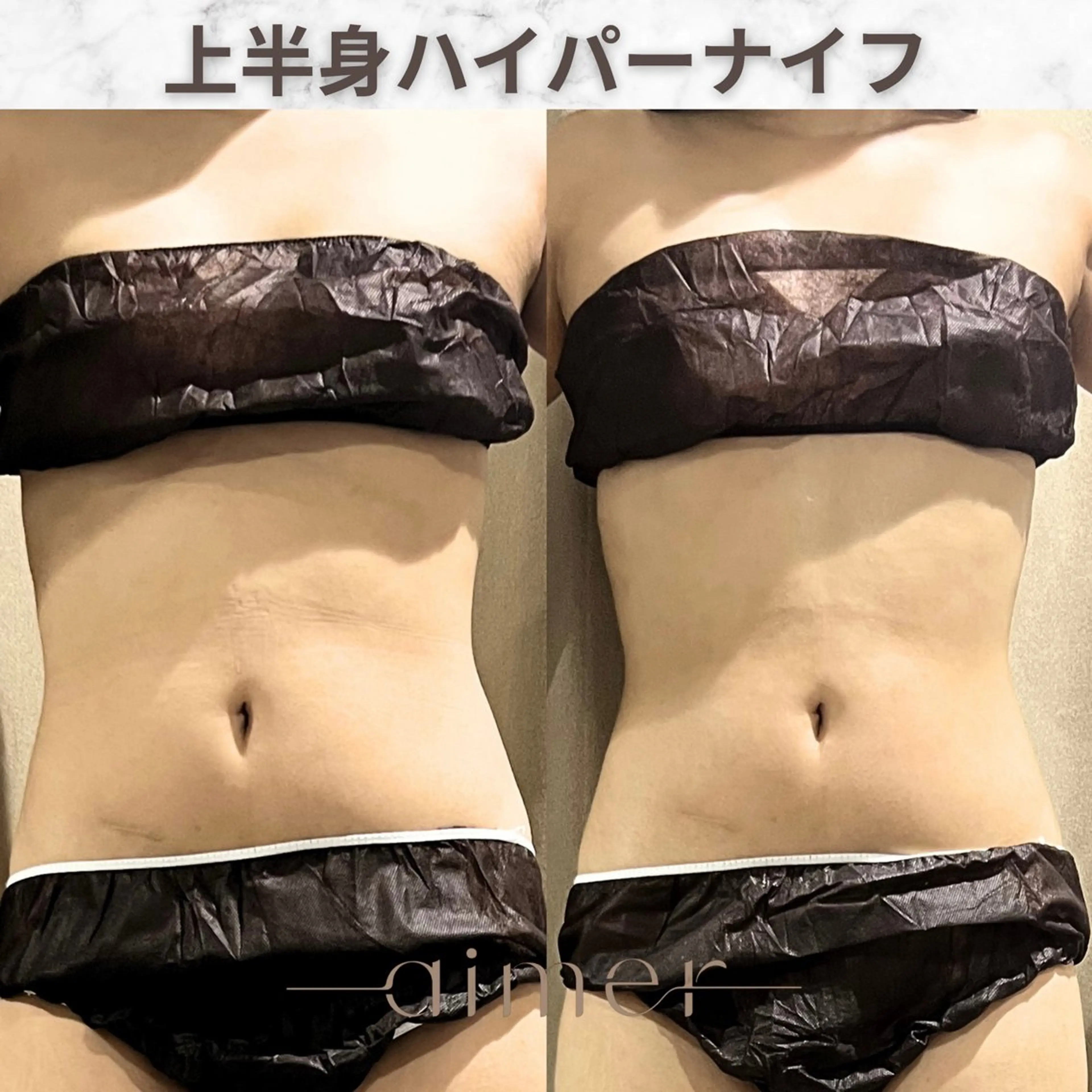 aimer服部 ♡  小顔 ・ 痩身のその他イメージ