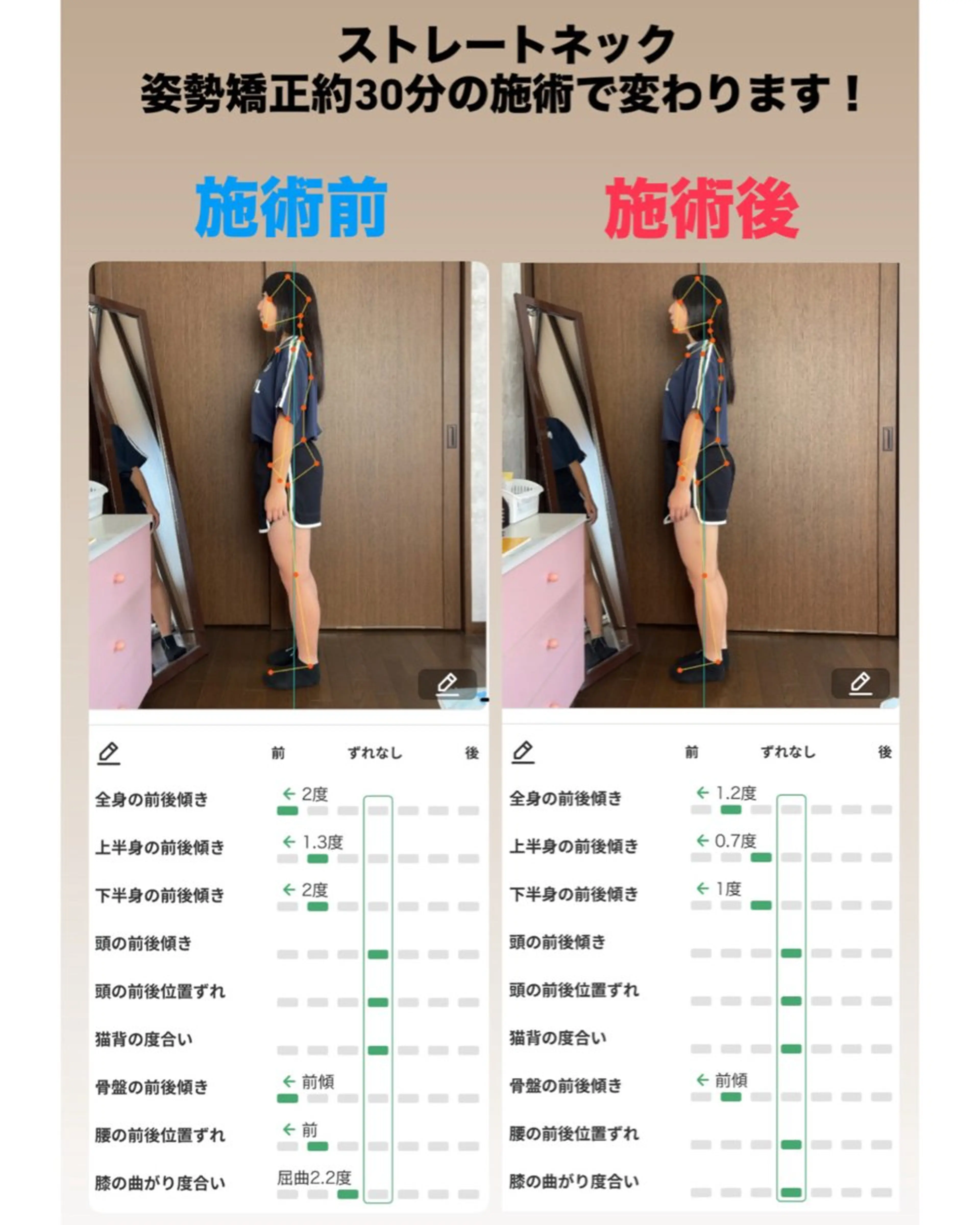【小学生中学生限定 】姿勢+ストレートネック矯正コースの写真