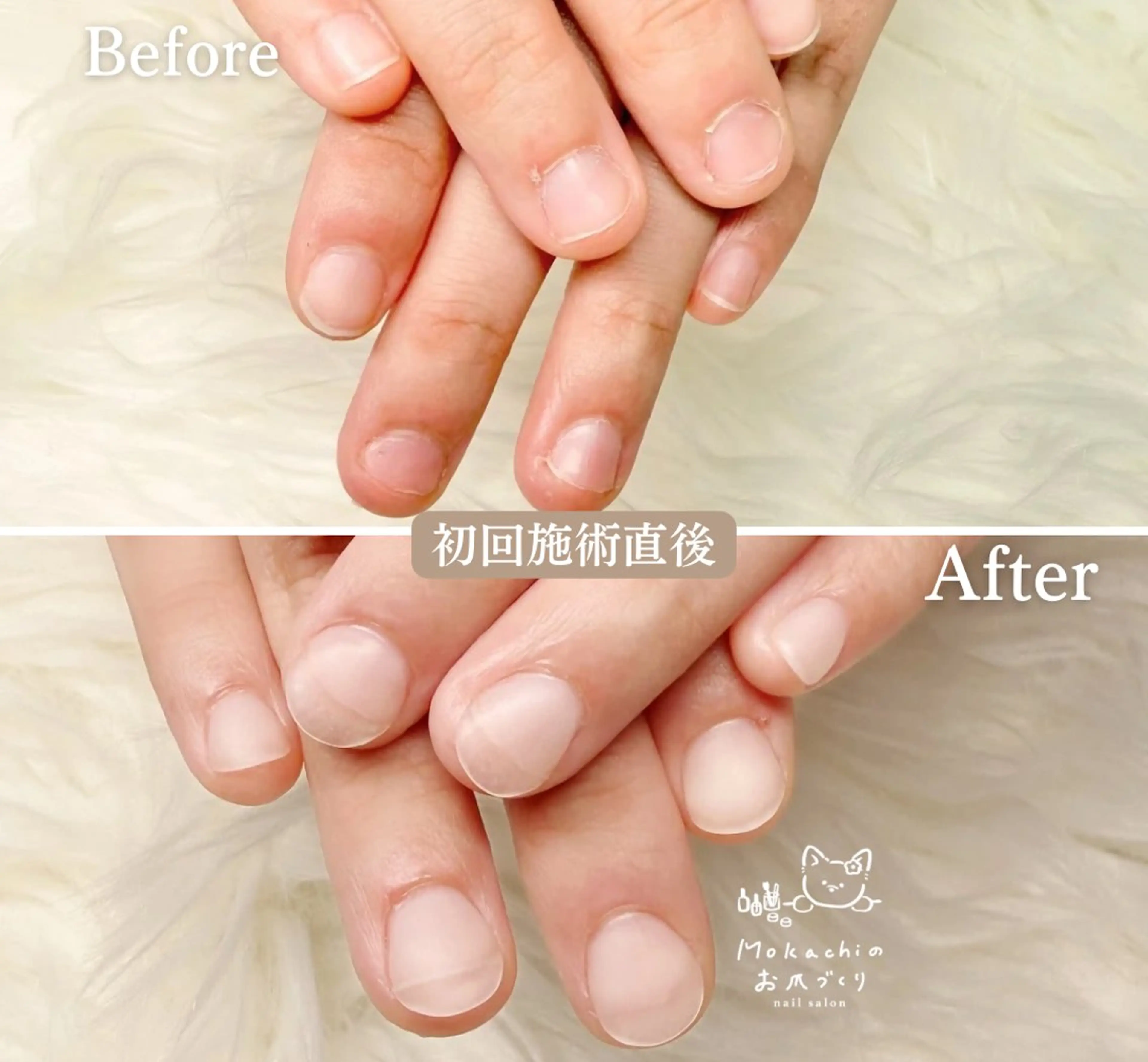 オフなし*深爪矯正*撮影モデル価格の写真