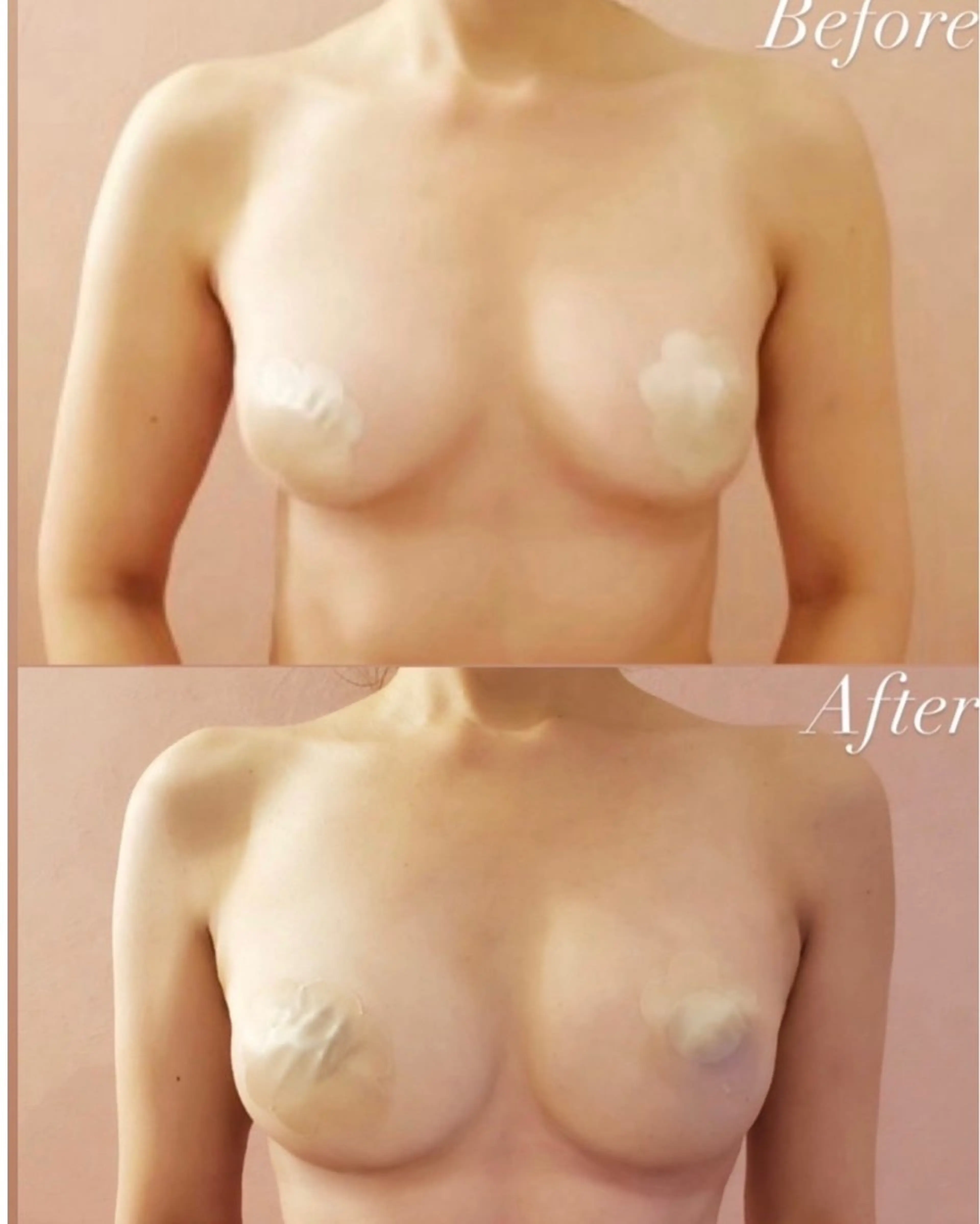 エステ ROSALIA 【バストアップ、痩身、毛穴洗浄】所属・最新育乳マシン使用！ バストアップ専門店のその他イメージ