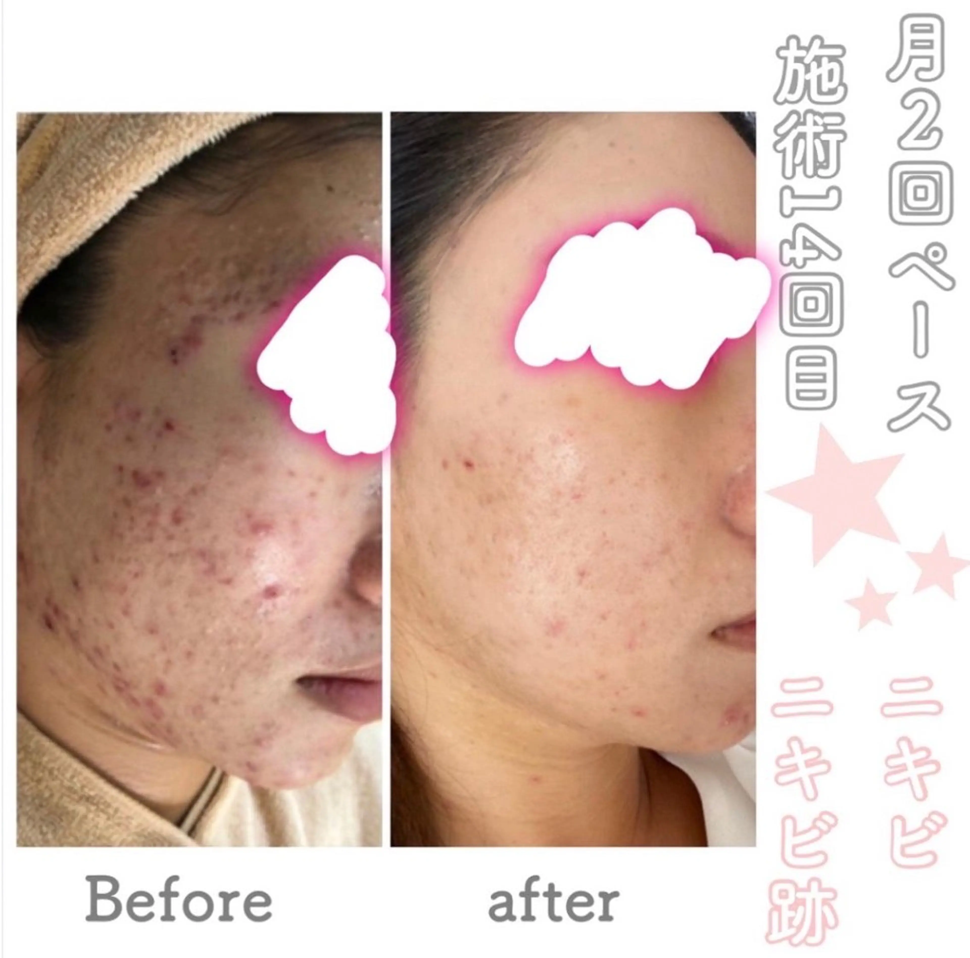 都度払い肌改善専門店 店長二上文香のエステ・リラクイメージ