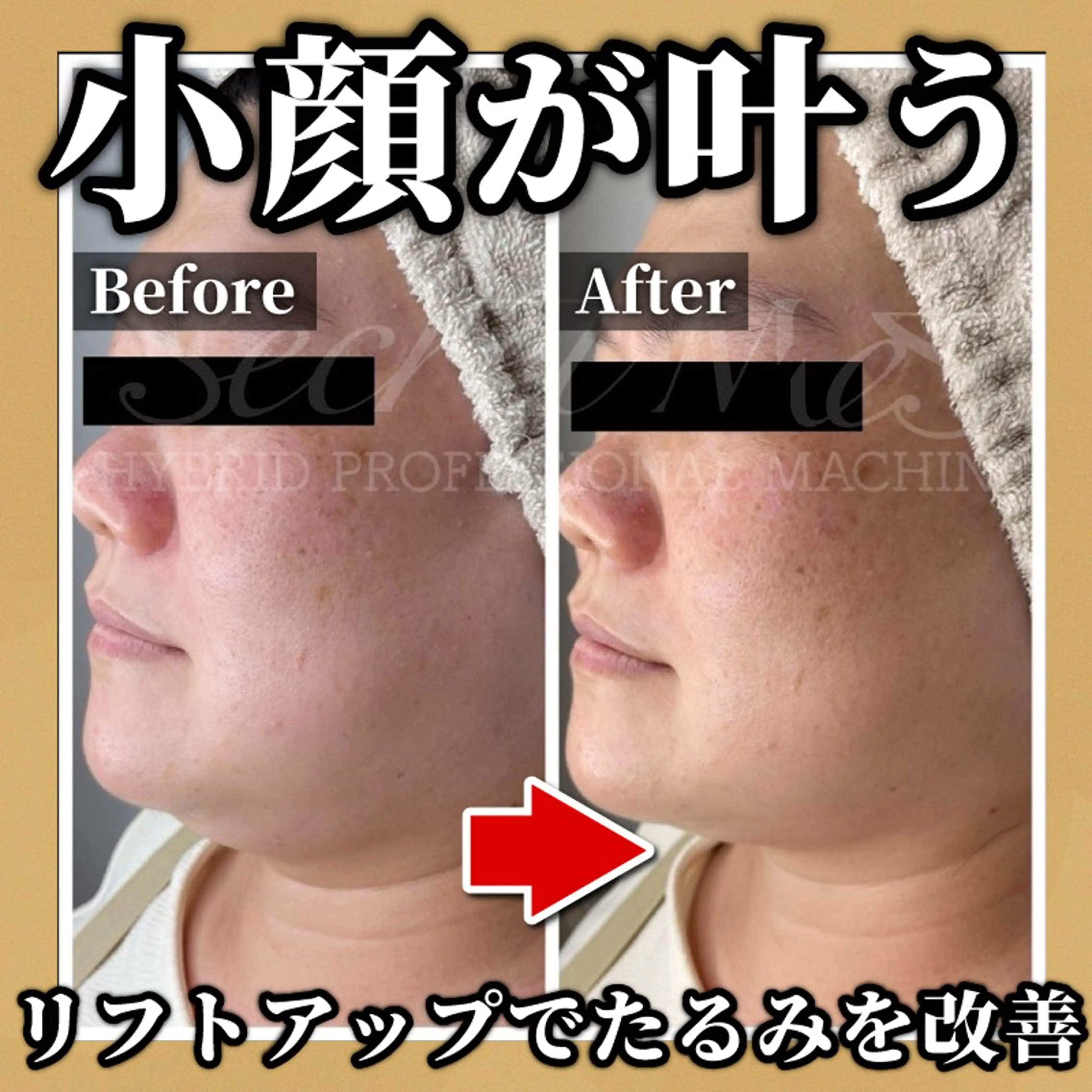 脱毛 TOWA大宮のエステ・リラクイメージ