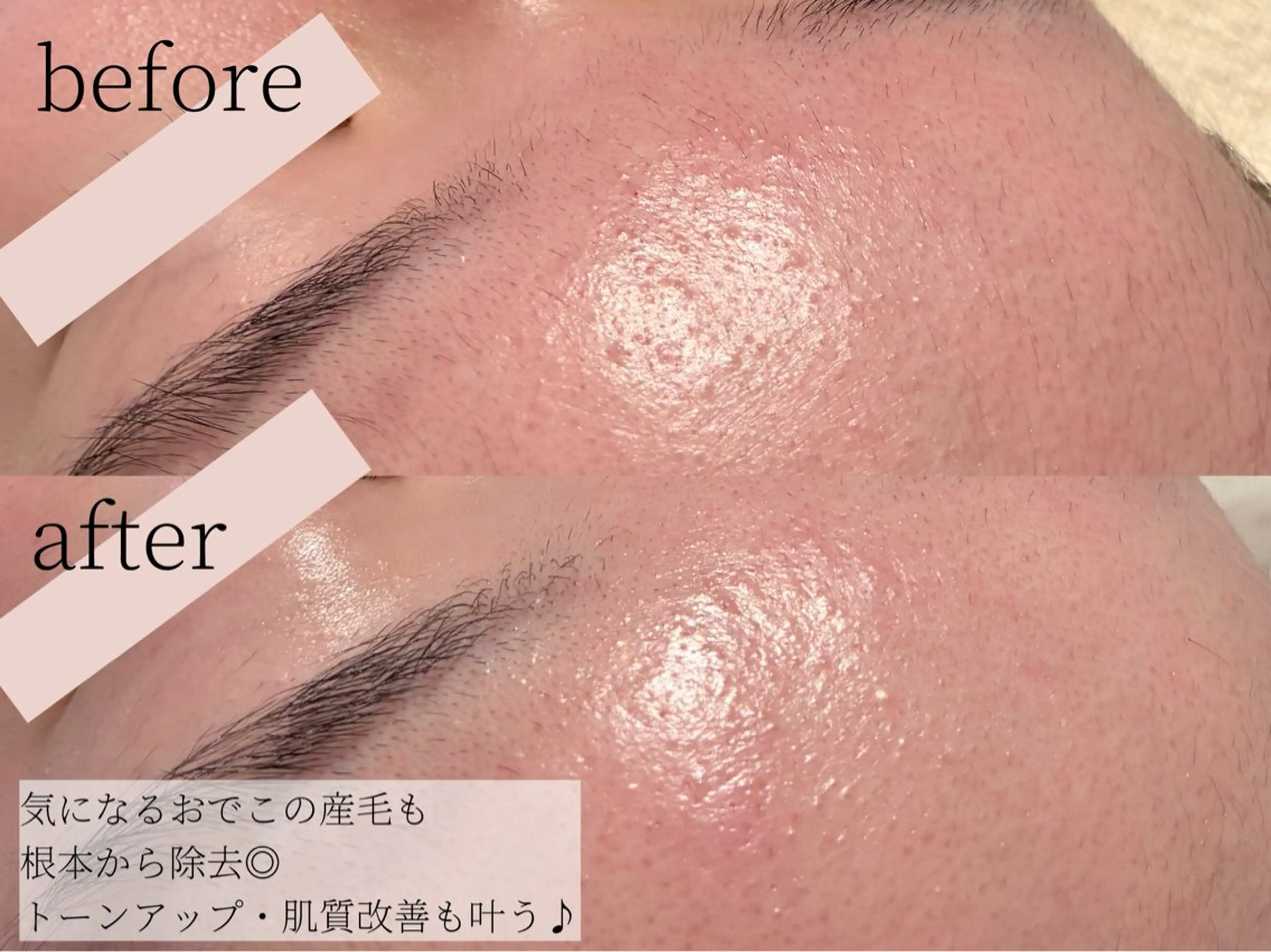 その他 Erika komorebi_のエステ・リラクイメージ