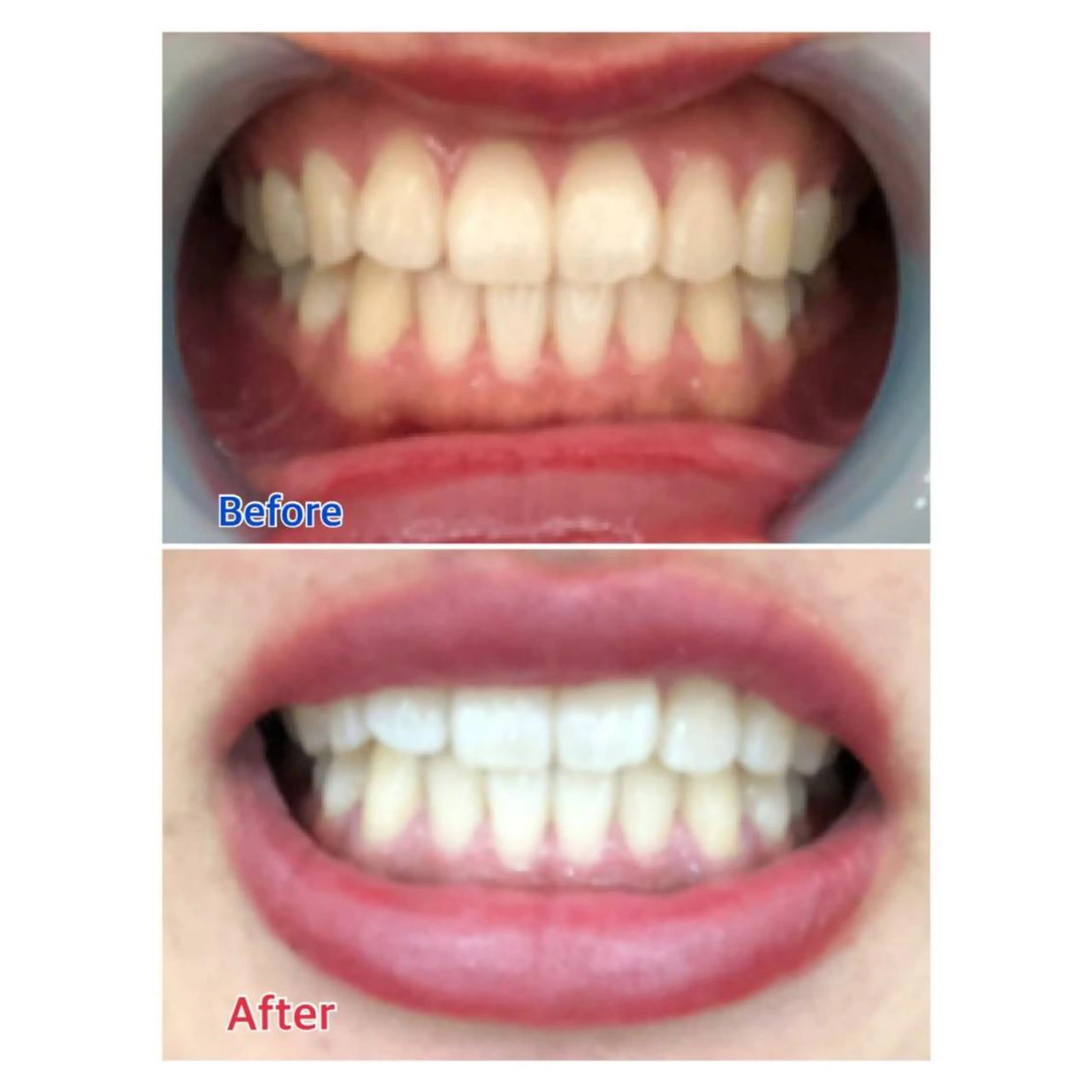 MBEAUTYSALON 千葉店・京成大久保所属・Melty 輝のその他イメージ