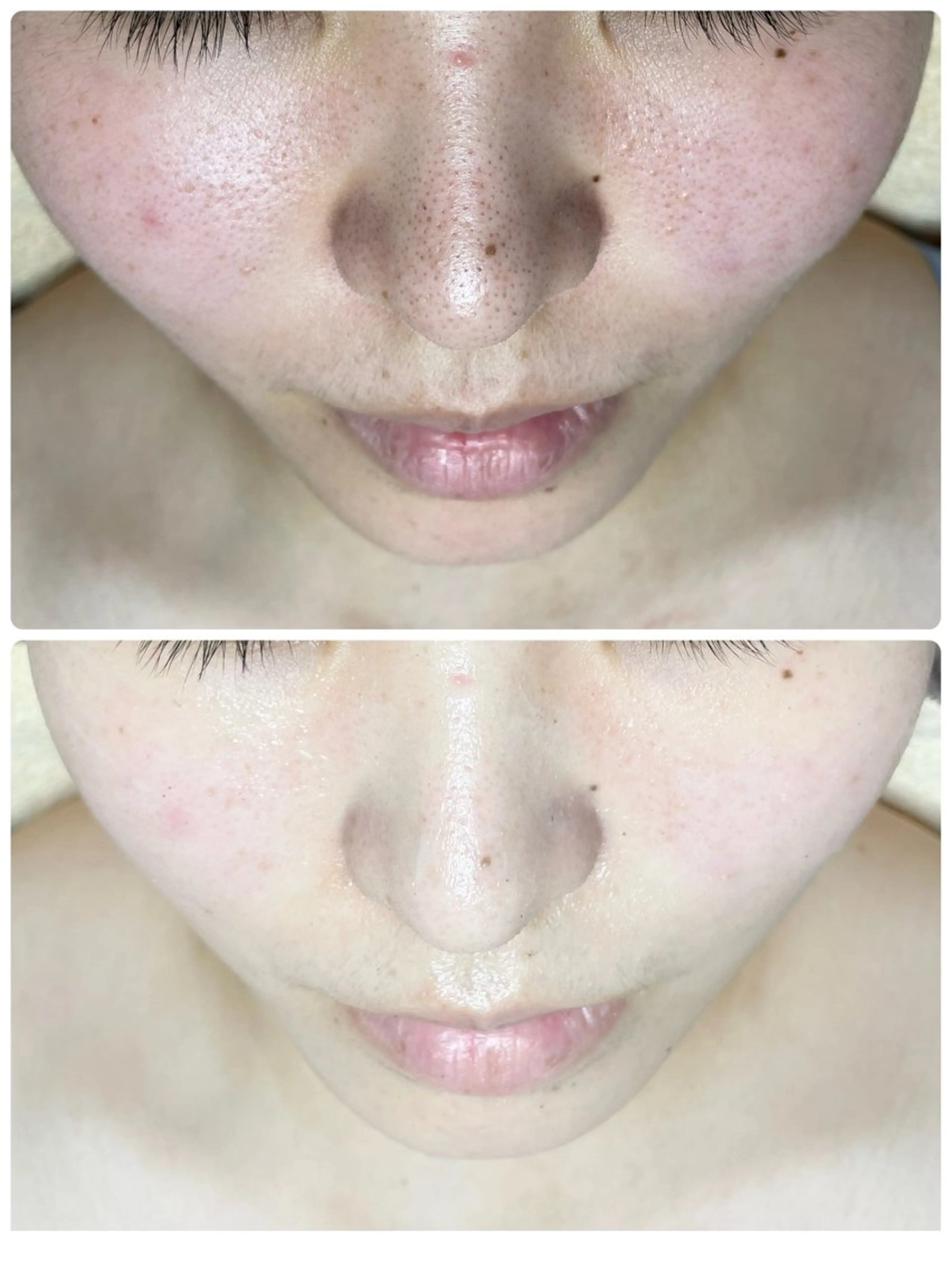 代表 MOMOのエステ・リラクイメージ