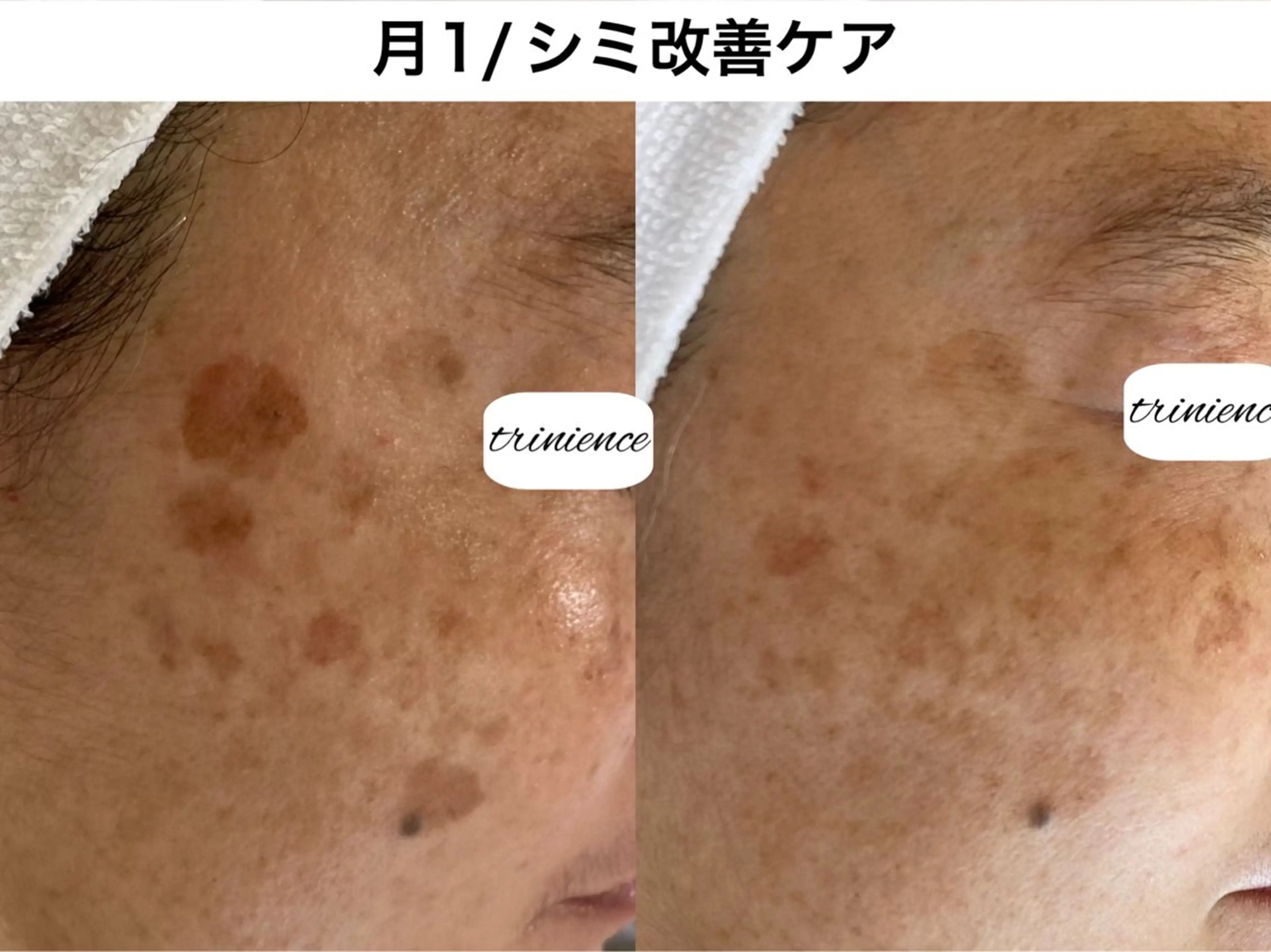 TRINIENCE 南流山店のエステ・リラクイメージ