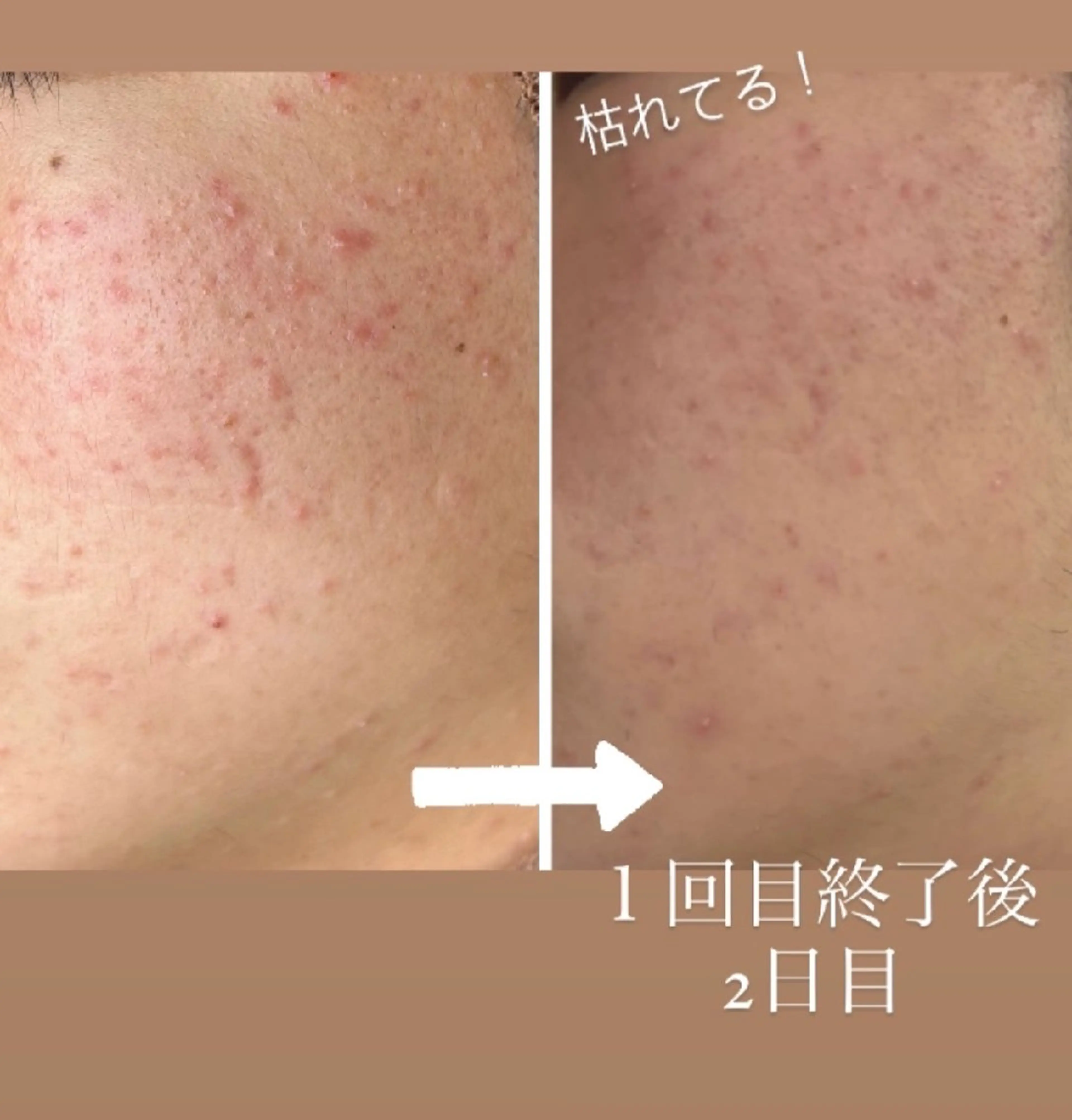 エステ sbeaute  エスボーテのエステ・リラクイメージ