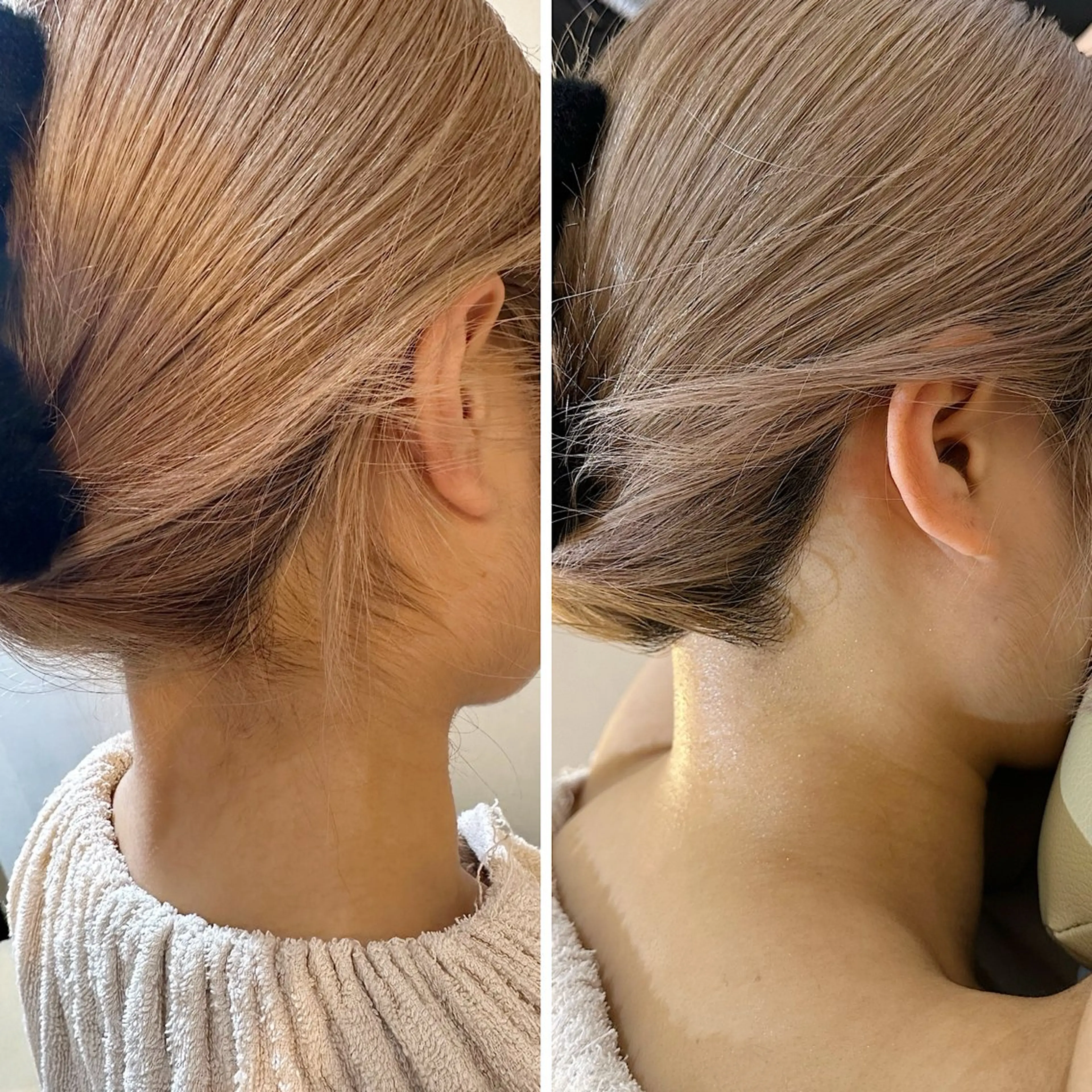 脱毛 うなじ脱毛/美肌脱毛 LABELのエステ・リラクイメージ