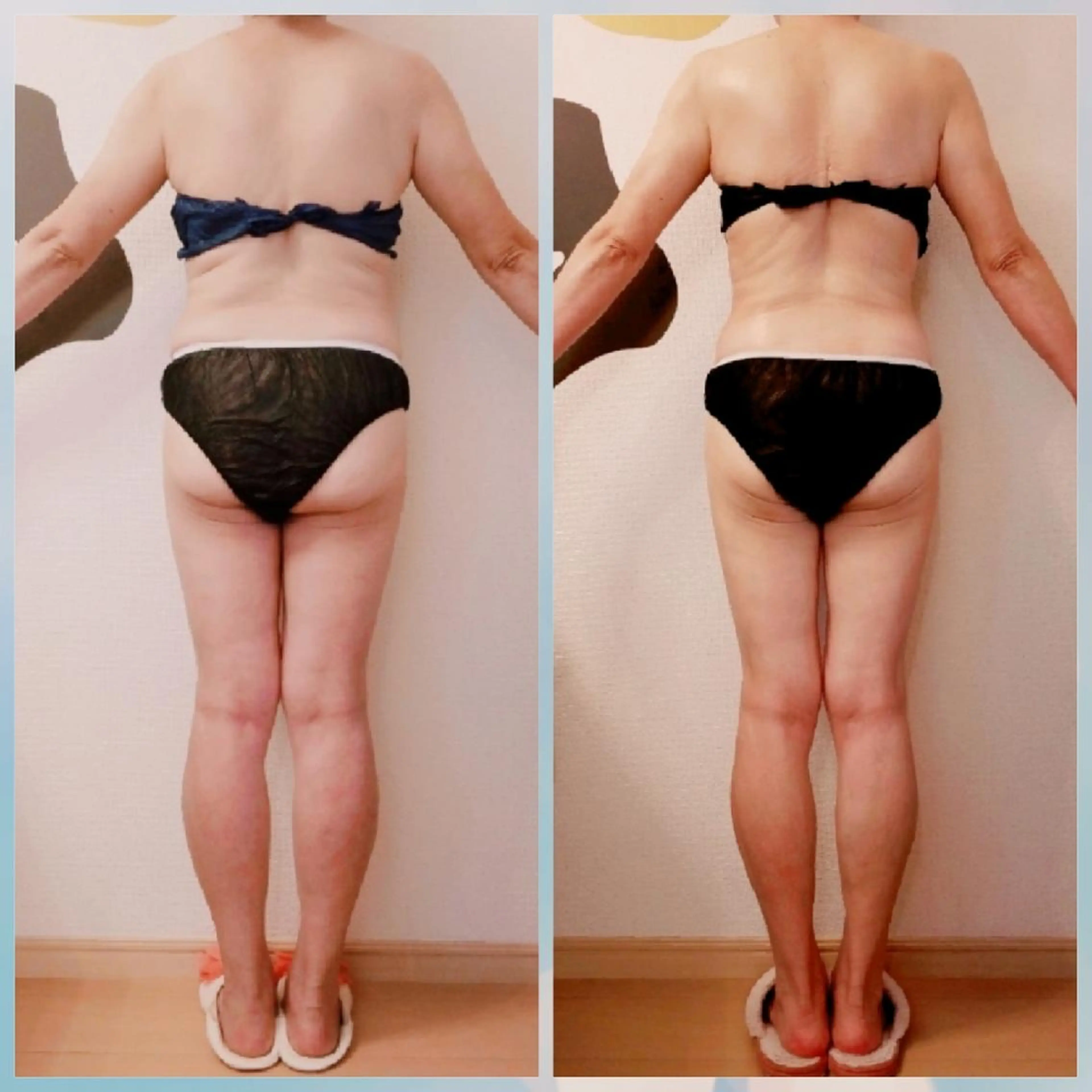 ハイクオリティー【別人ハイレベル痩身】全身の写真