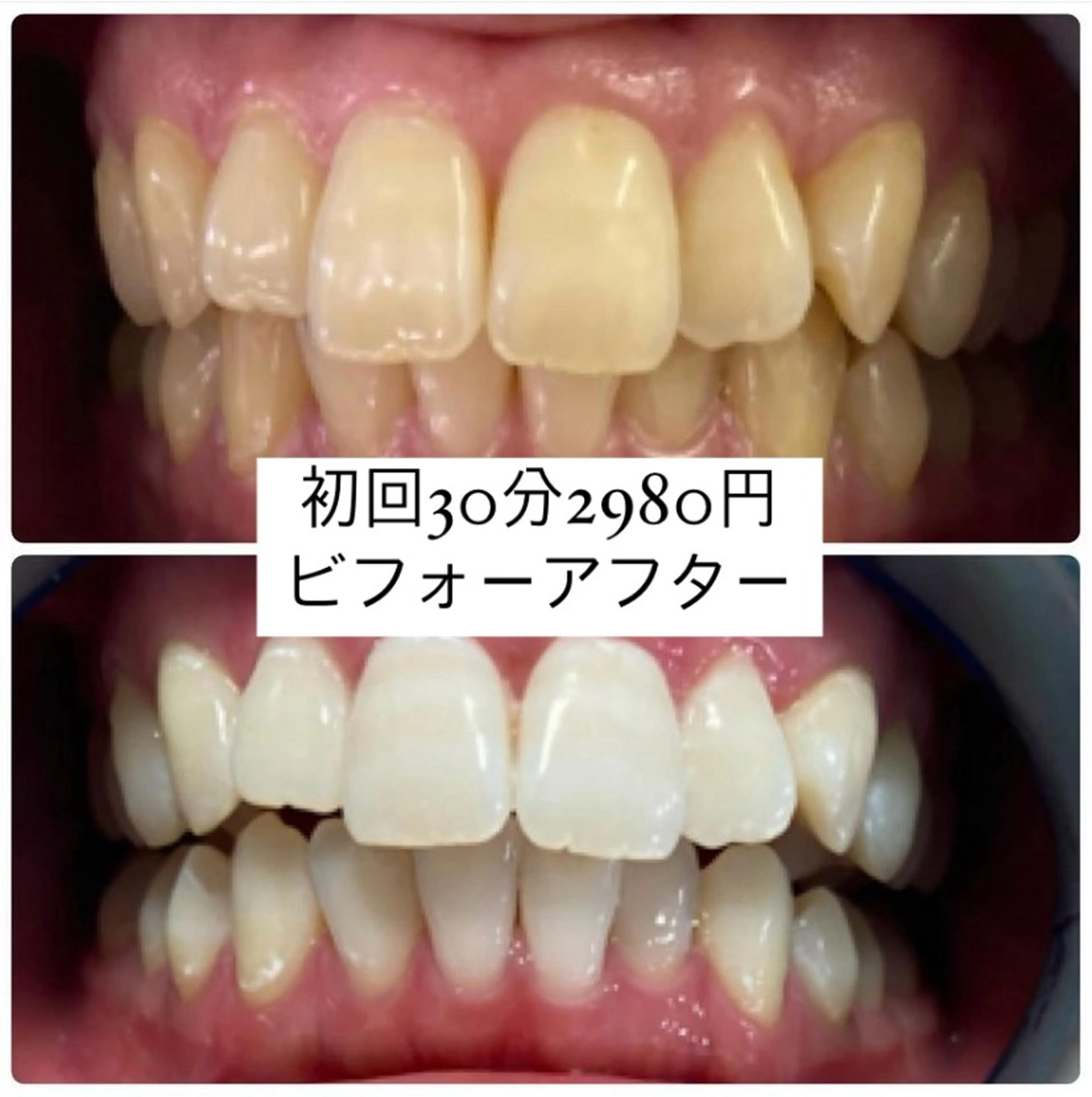 その他 ホワイトニングルーム 横浜店のその他イメージ