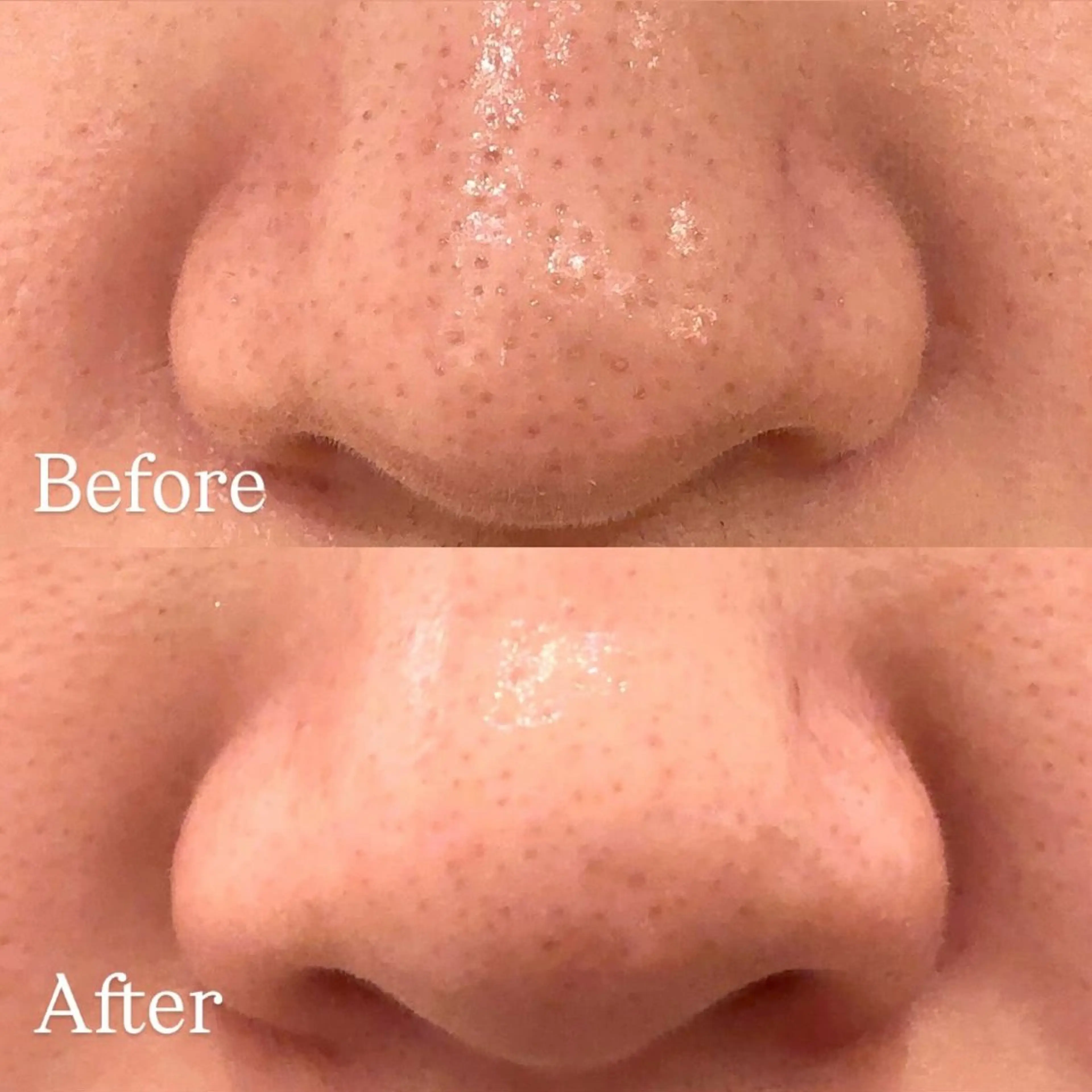 chika🦋 ハリラウンジ恵比寿のエステ・リラクイメージ