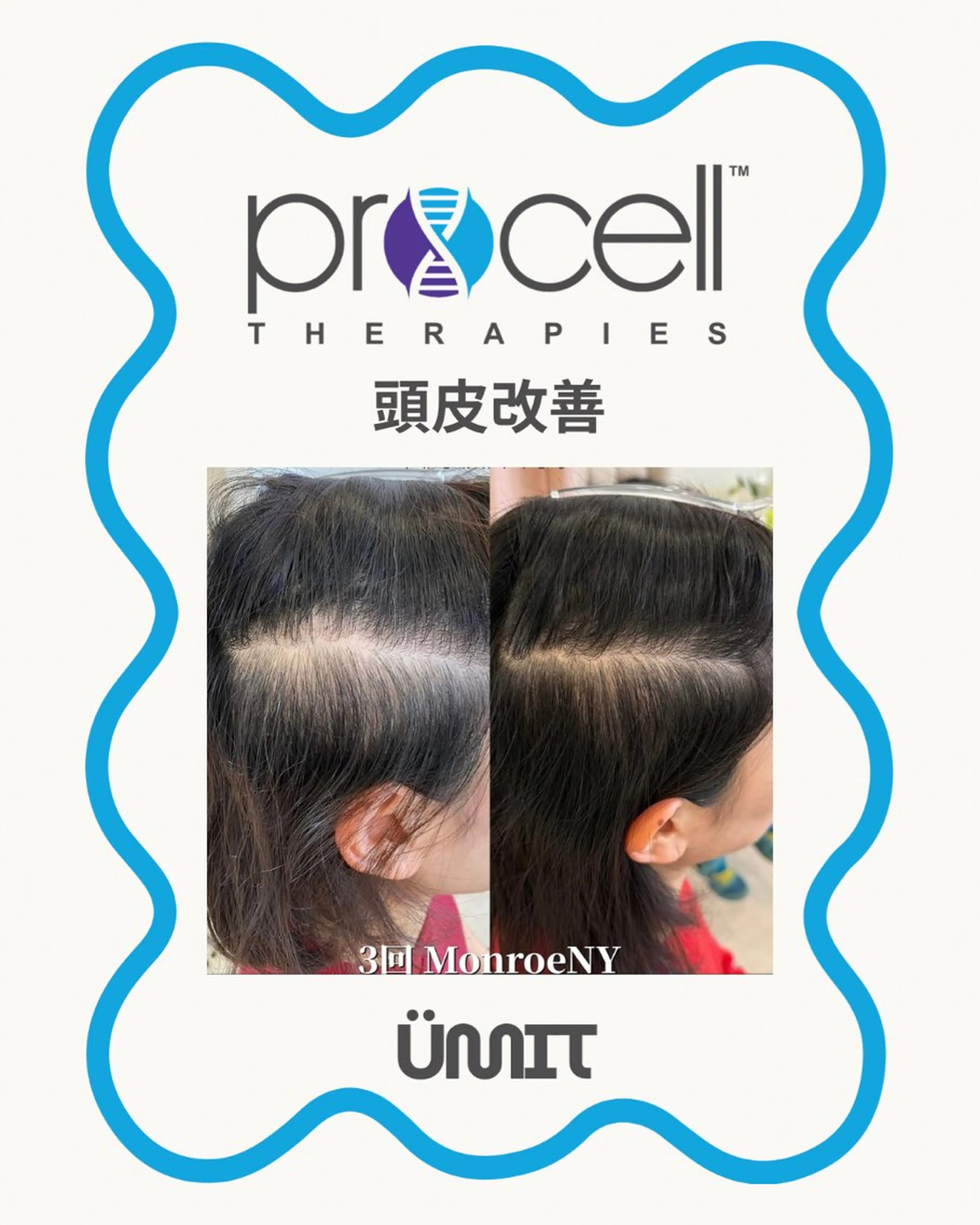 ヘッドスパ Ümit（ユミト） プロセルセラピーズのネイルデザイン