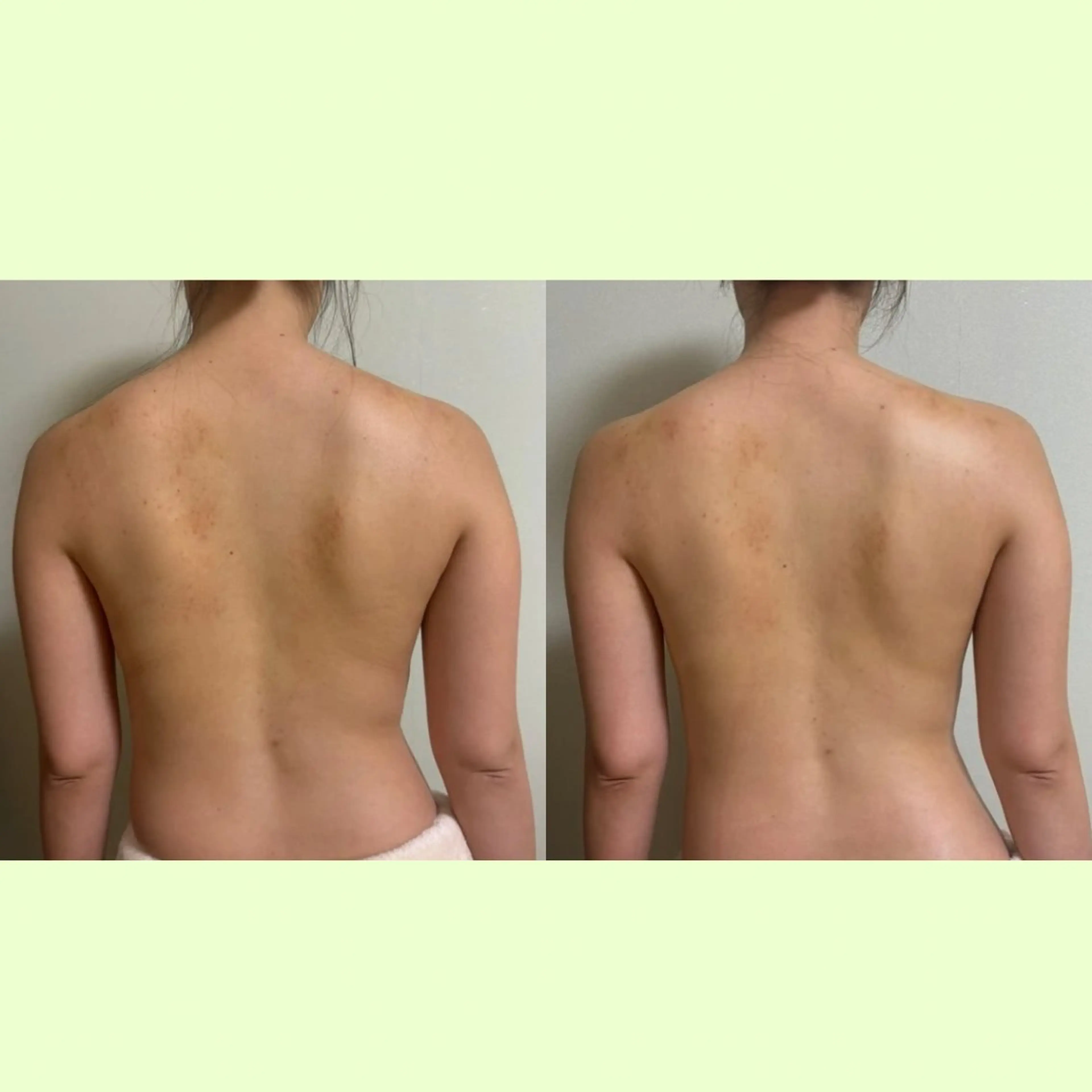 spaHINOKI 【女性専用】のエステ・リラクイメージ