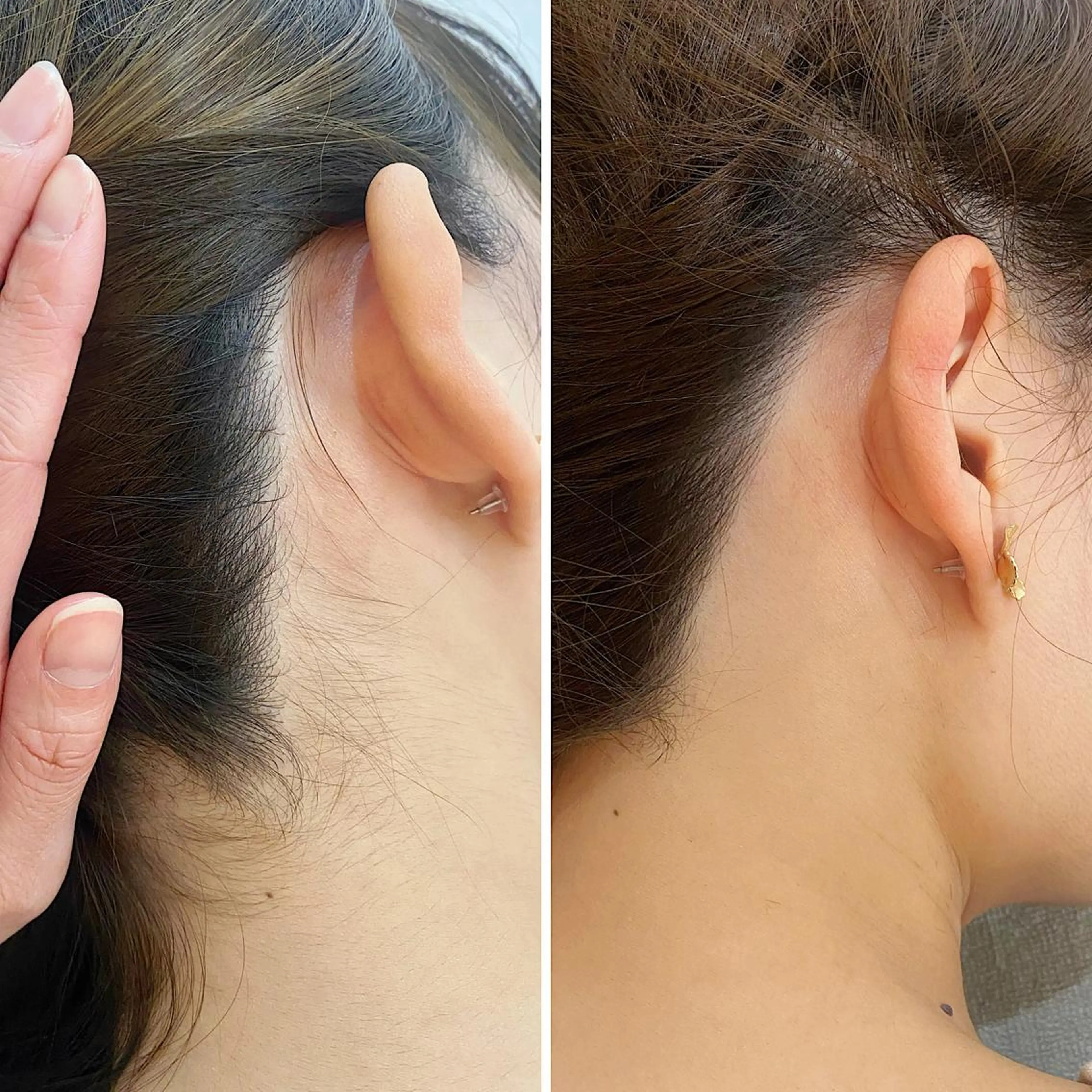 脱毛 うなじ脱毛/美肌脱毛 LABELのエステ・リラクイメージ