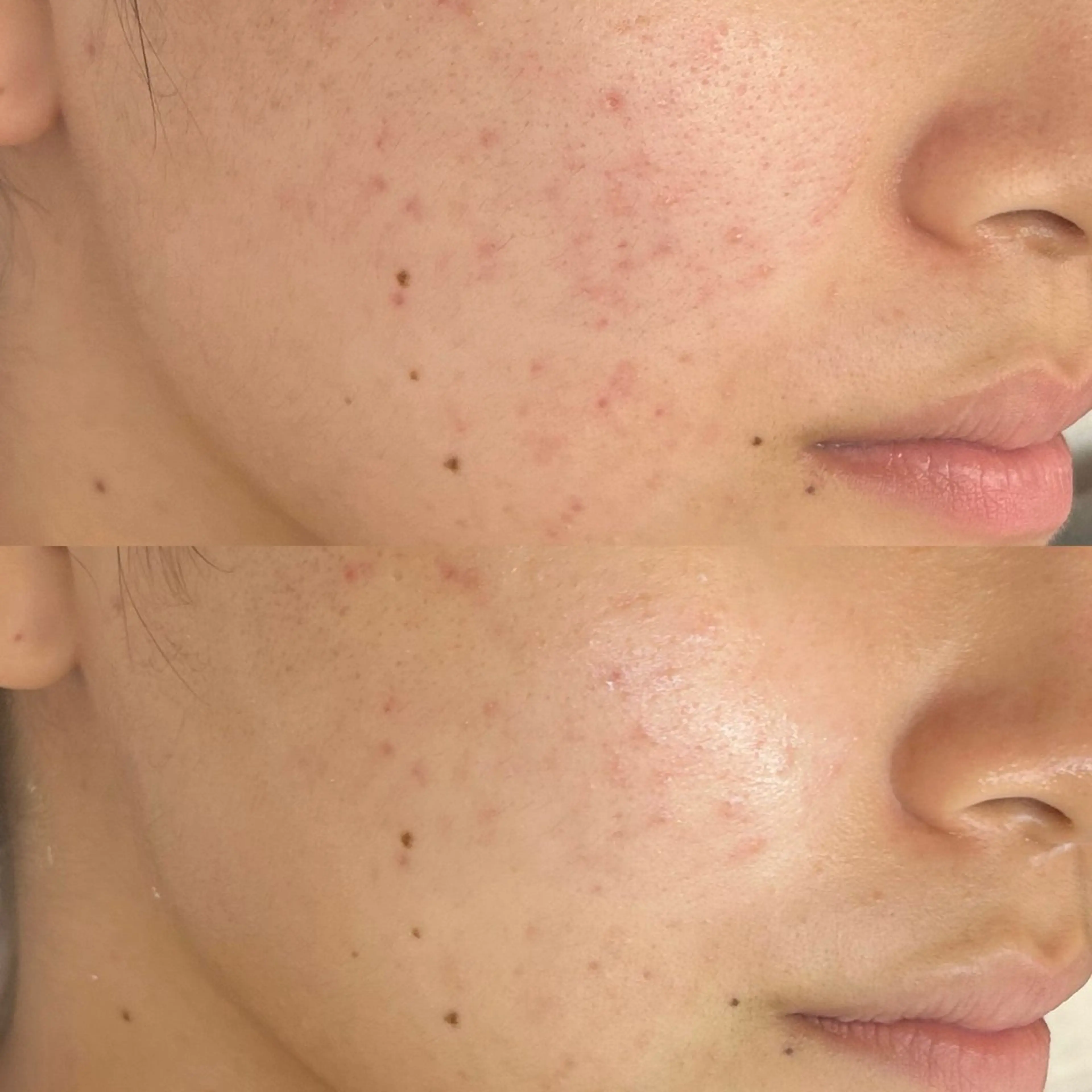 エステ 韓国🇰🇷価格 サロン_Nbibiの眉毛・アイブロウイメージ