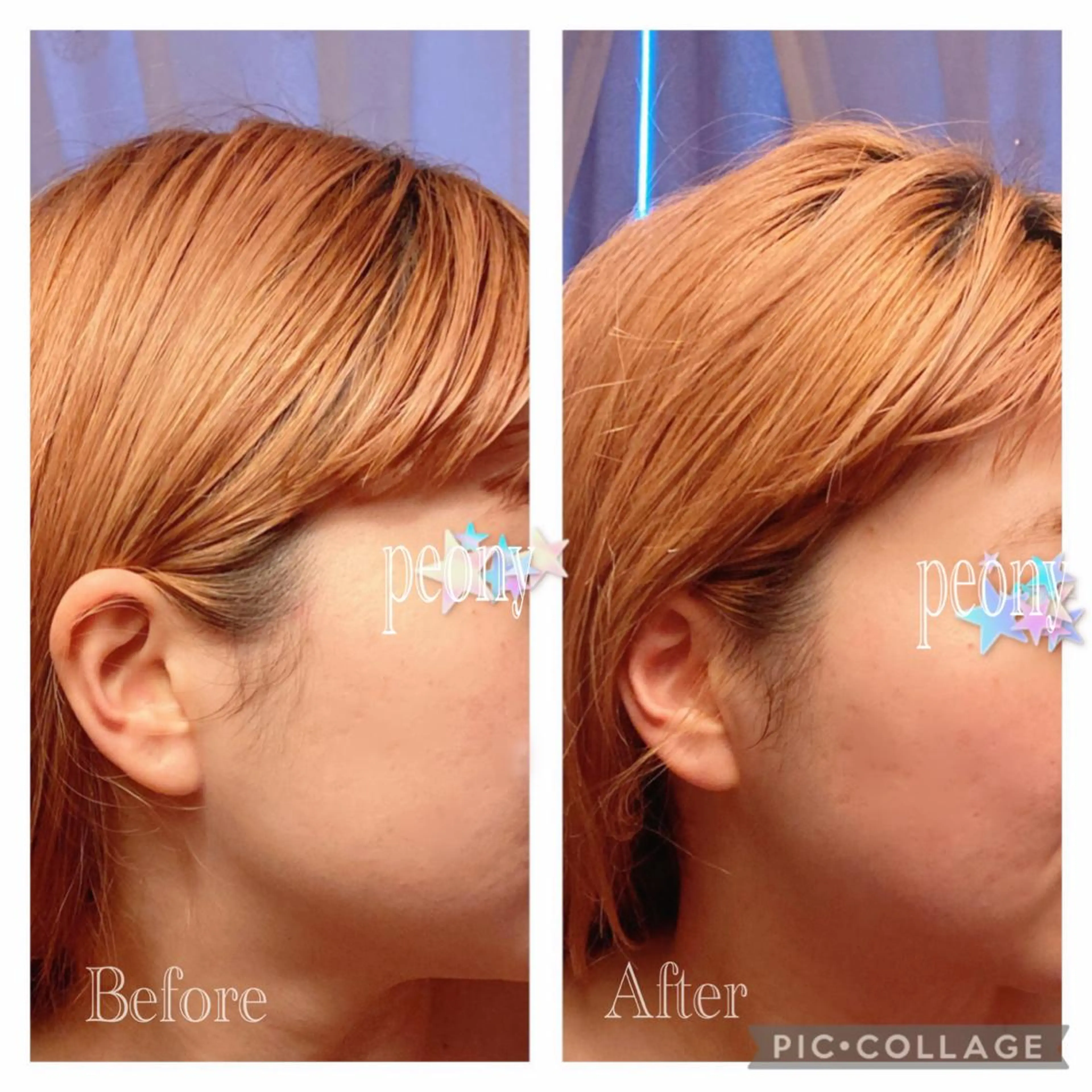 その他 デトックス美容専門 サロンｐｅｏｎｙのエステ・リラクイメージ