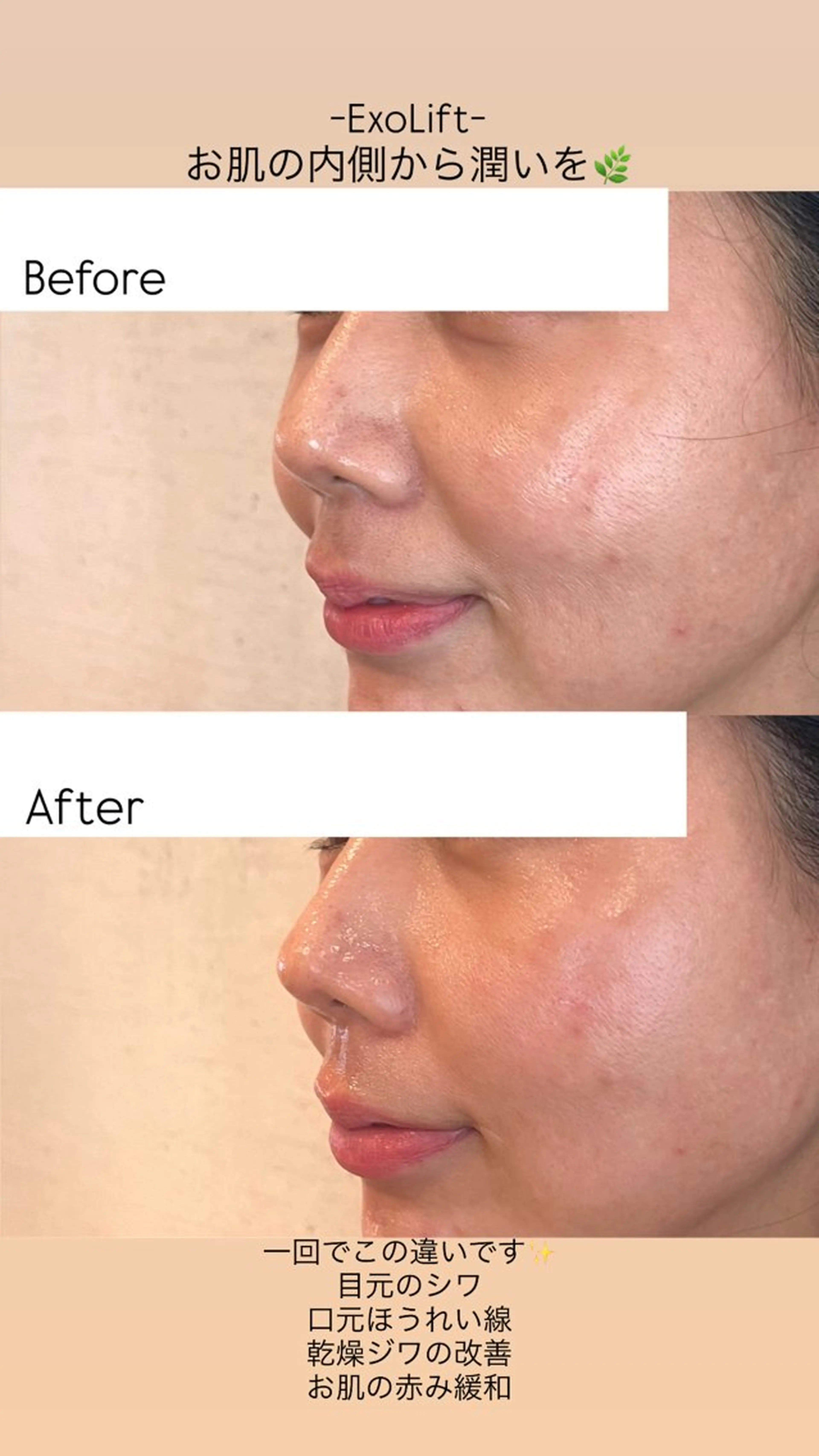 エステ Joo🌿ナツキ 肌育/エイジングのその他イメージ