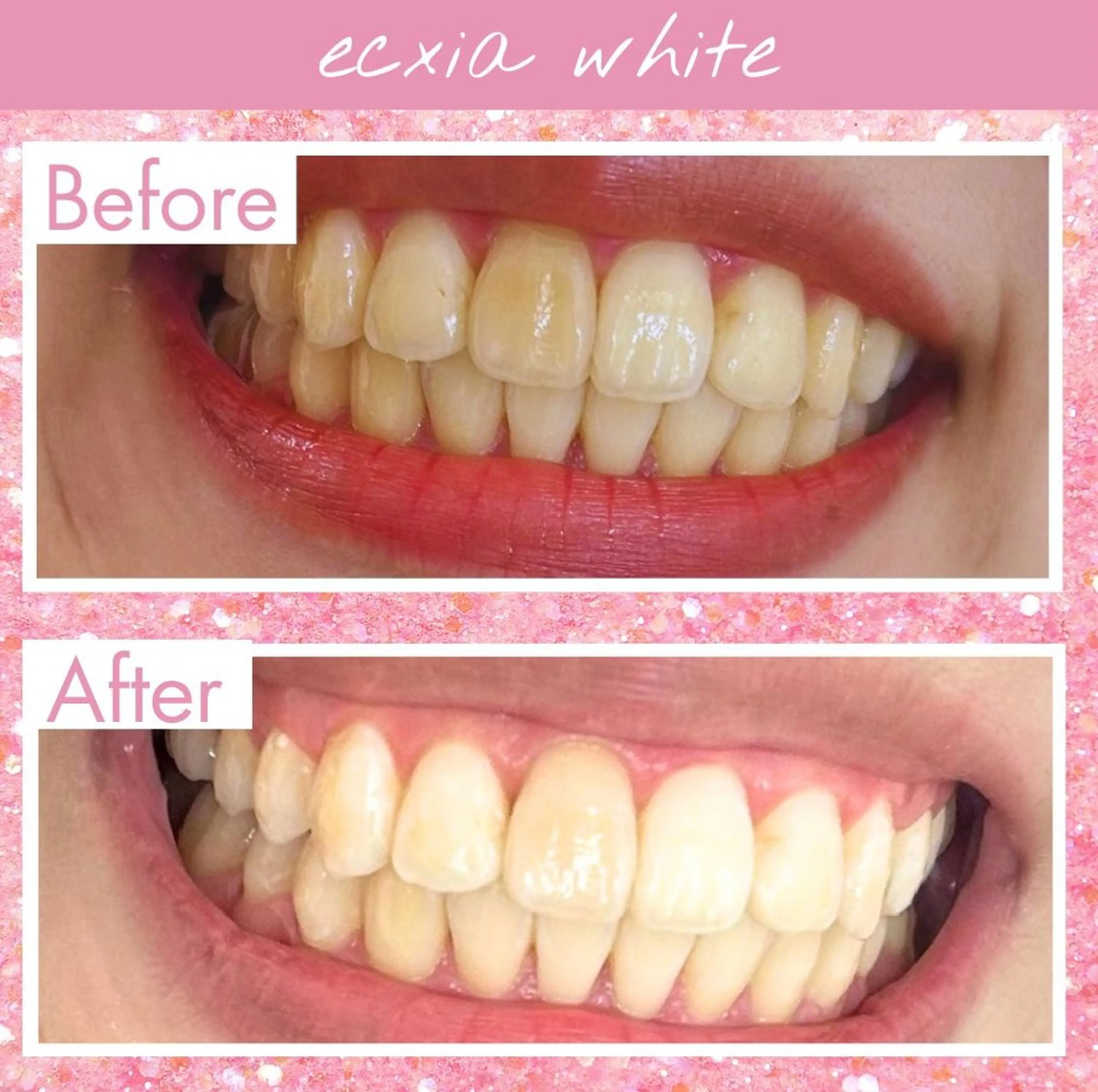 エクシアホワイト奥田店所属・エクシアホワイト 奥田店のその他イメージ