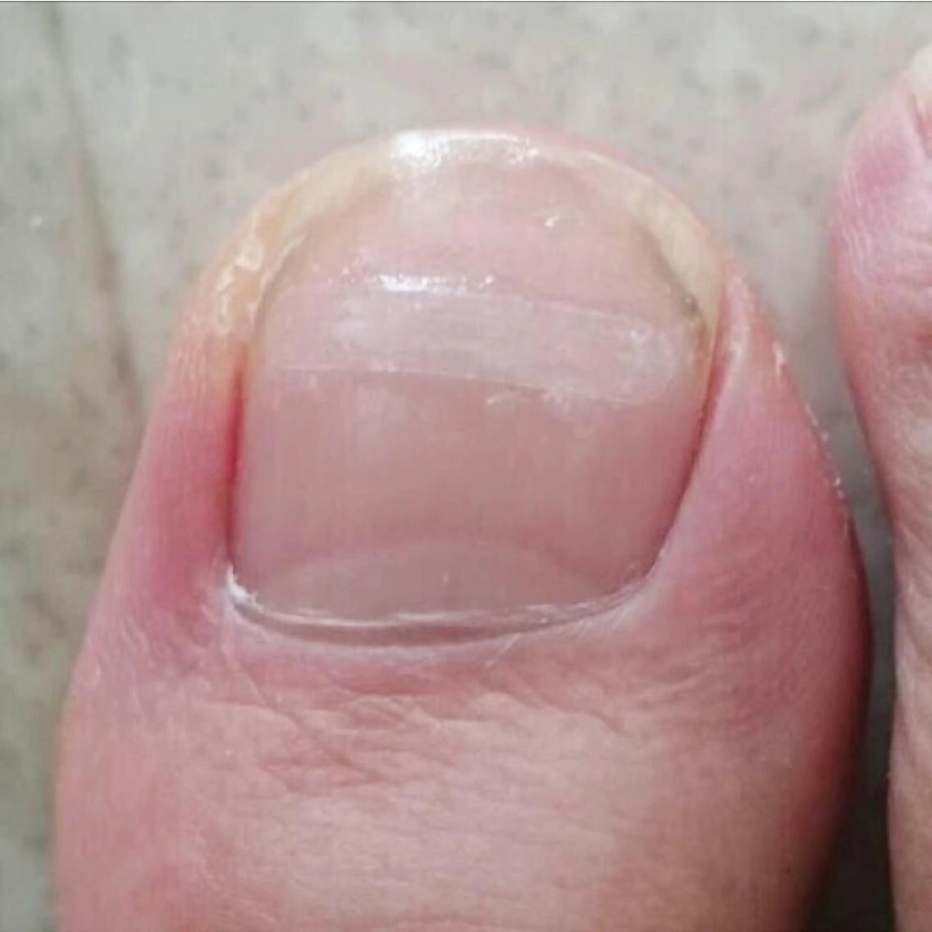 メンズ キッズ ネイル 🌱 ま し お 🌱のその他イメージ