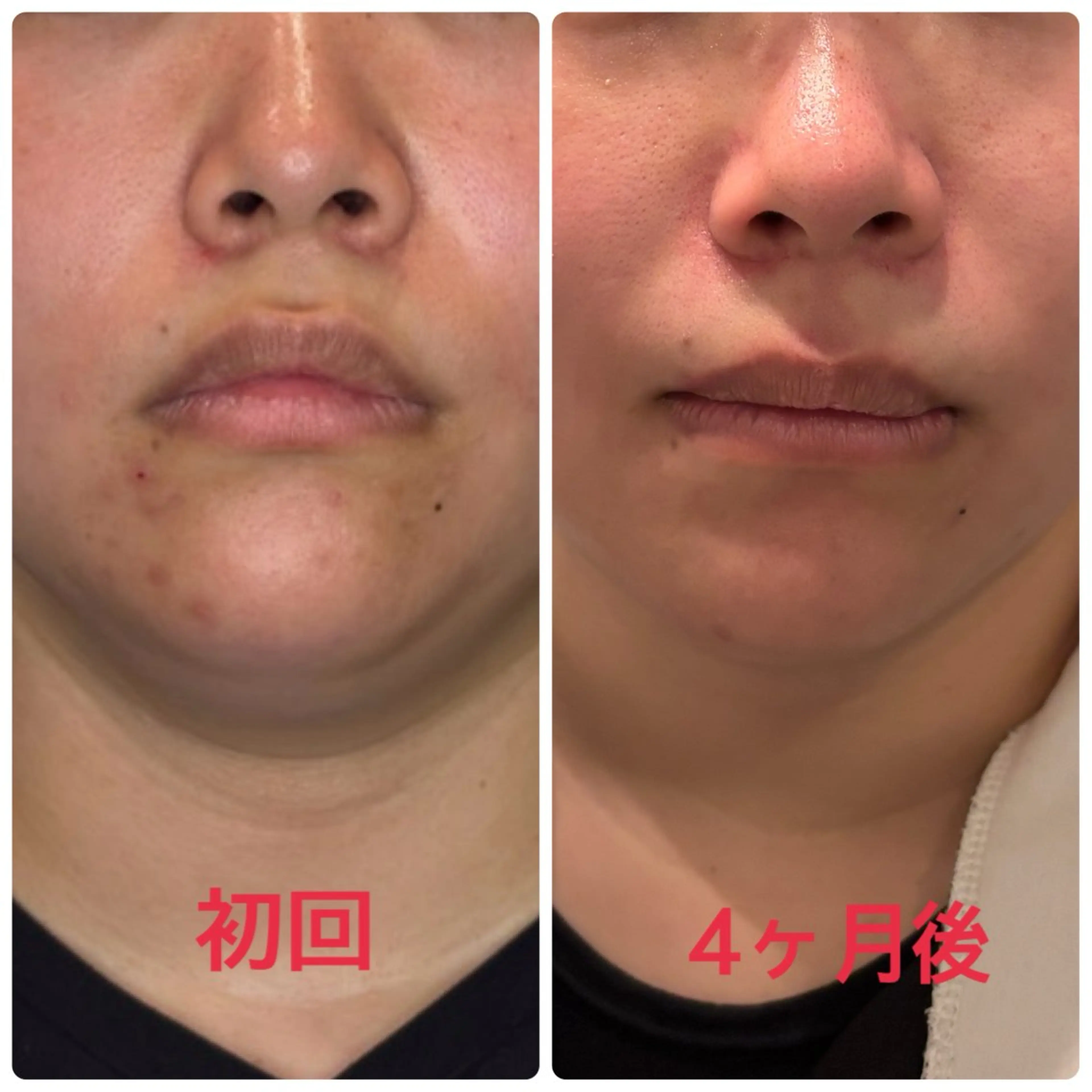 エステ リラク 小林整骨院本町 美容鍼roomのエステ・リラクイメージ