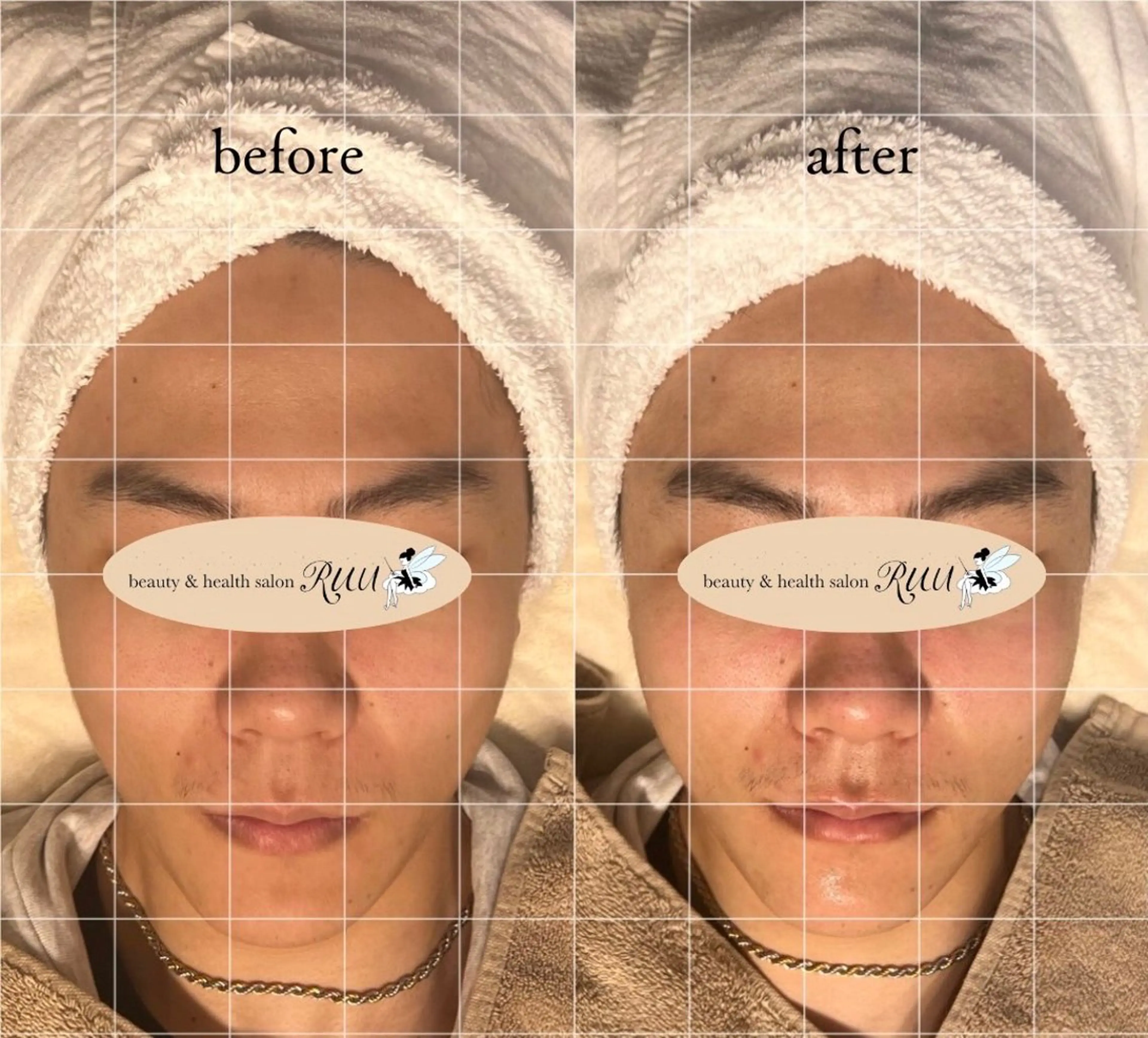 【頭痛、睡眠改善】 salon RUUのエステ・リラクイメージ