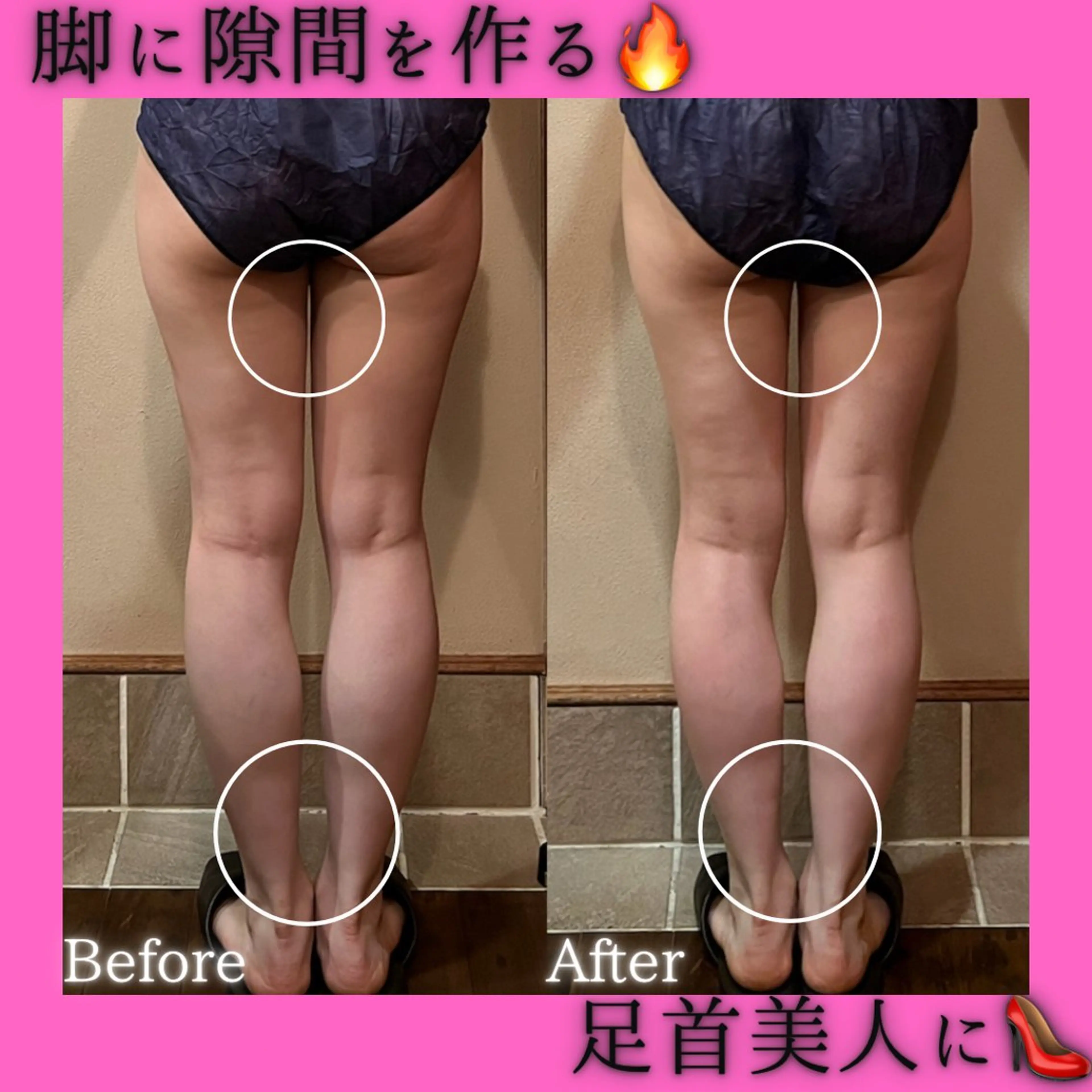 エステ リラク 痩身&美肌サロン 堀米✨のその他イメージ