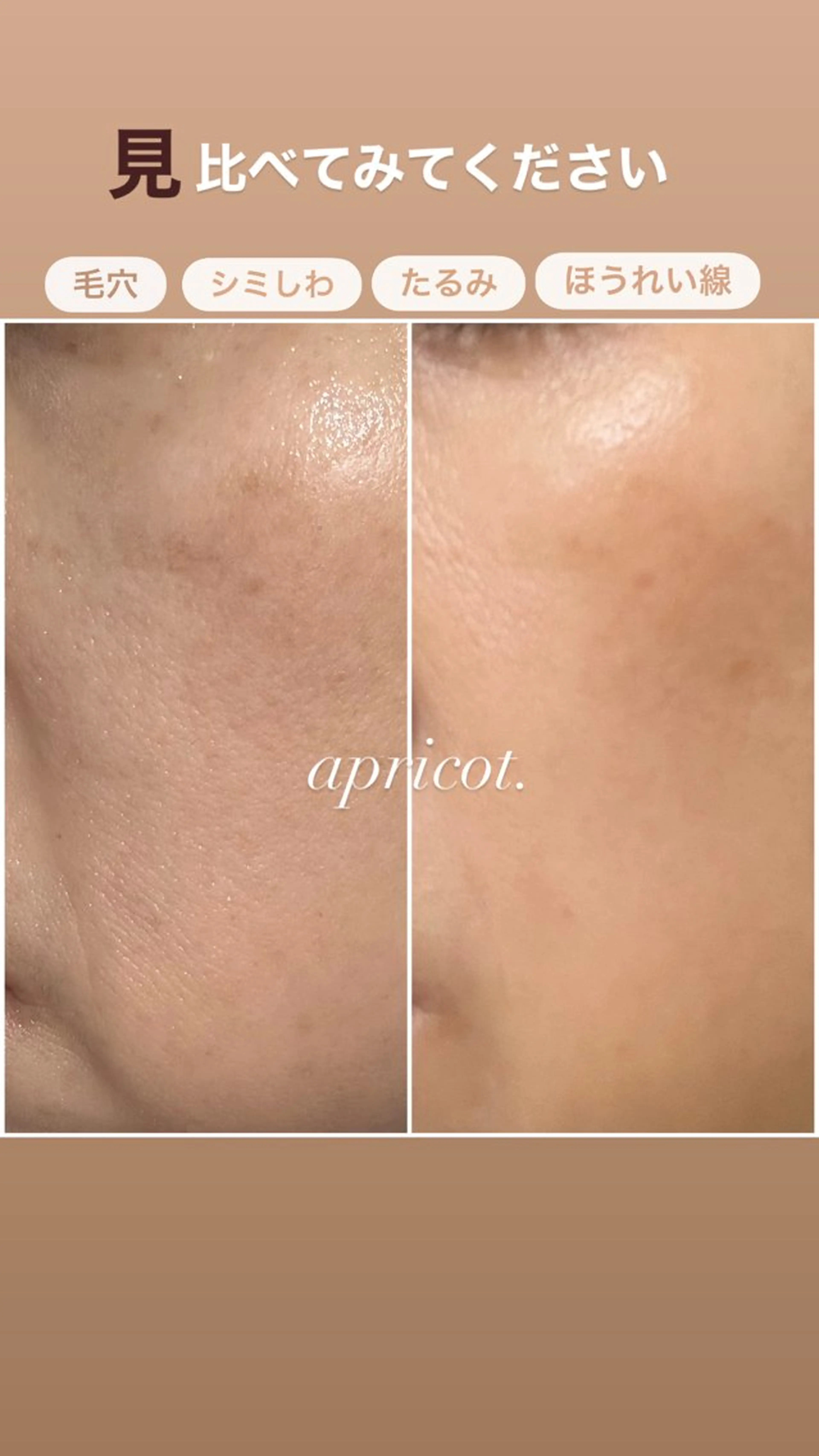 ヘッドスパ専門/豊中 apricotのエステ・リラクイメージ