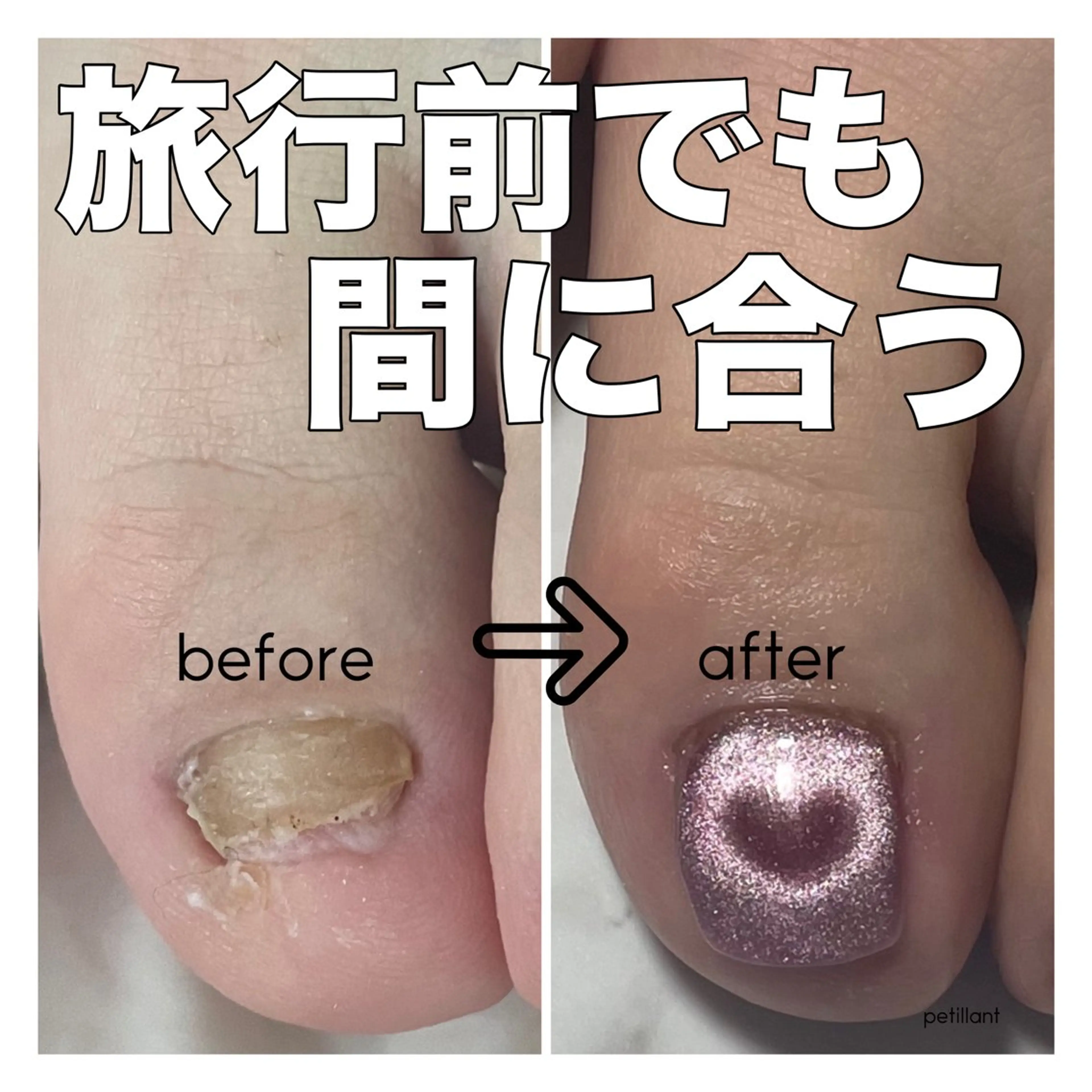 ネイル アートネイル フットネイル nail salon petillantのネイルデザイン