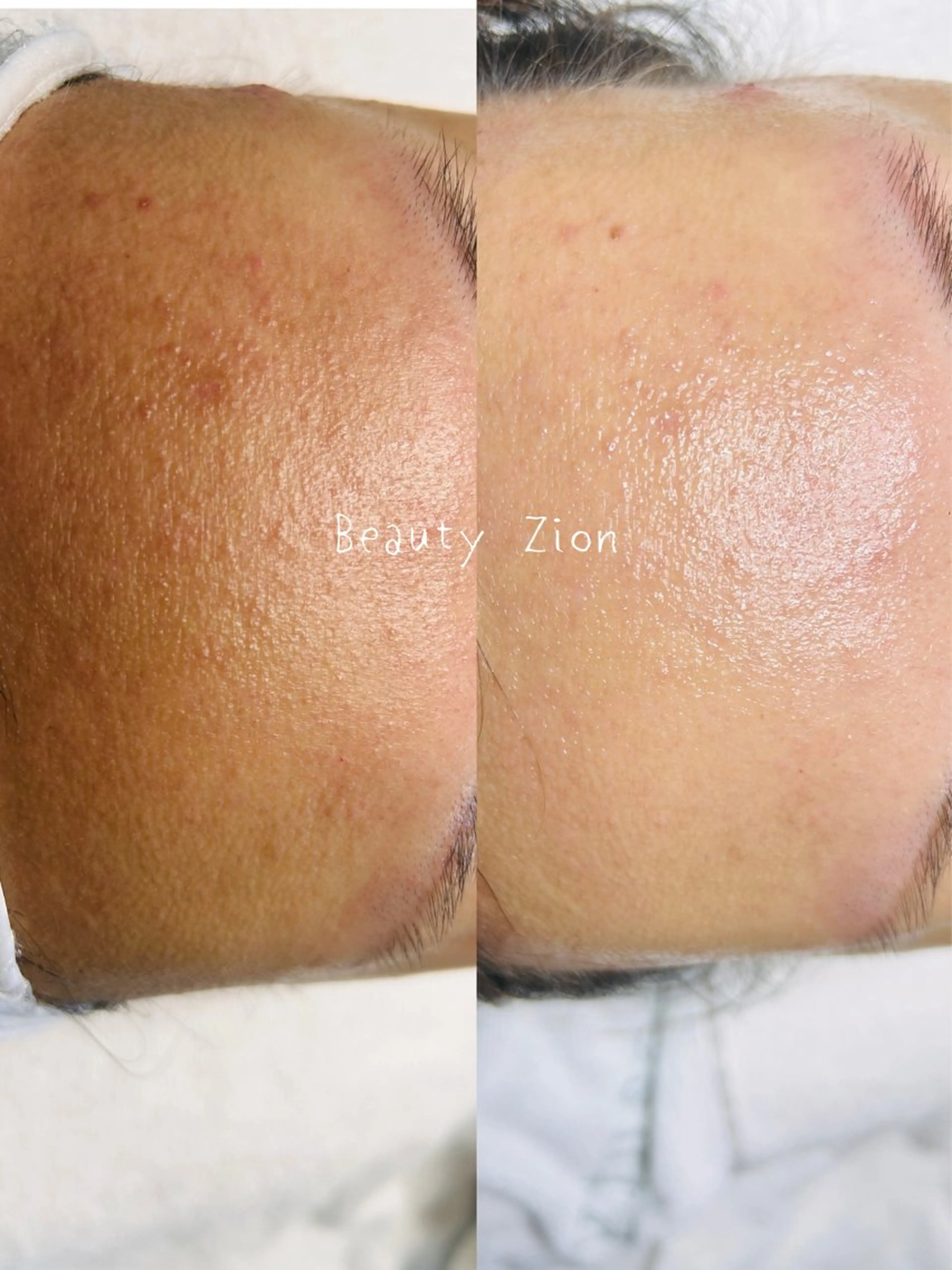 Beauty Zion所属・Beauty Zionのエステ・リラクイメージ