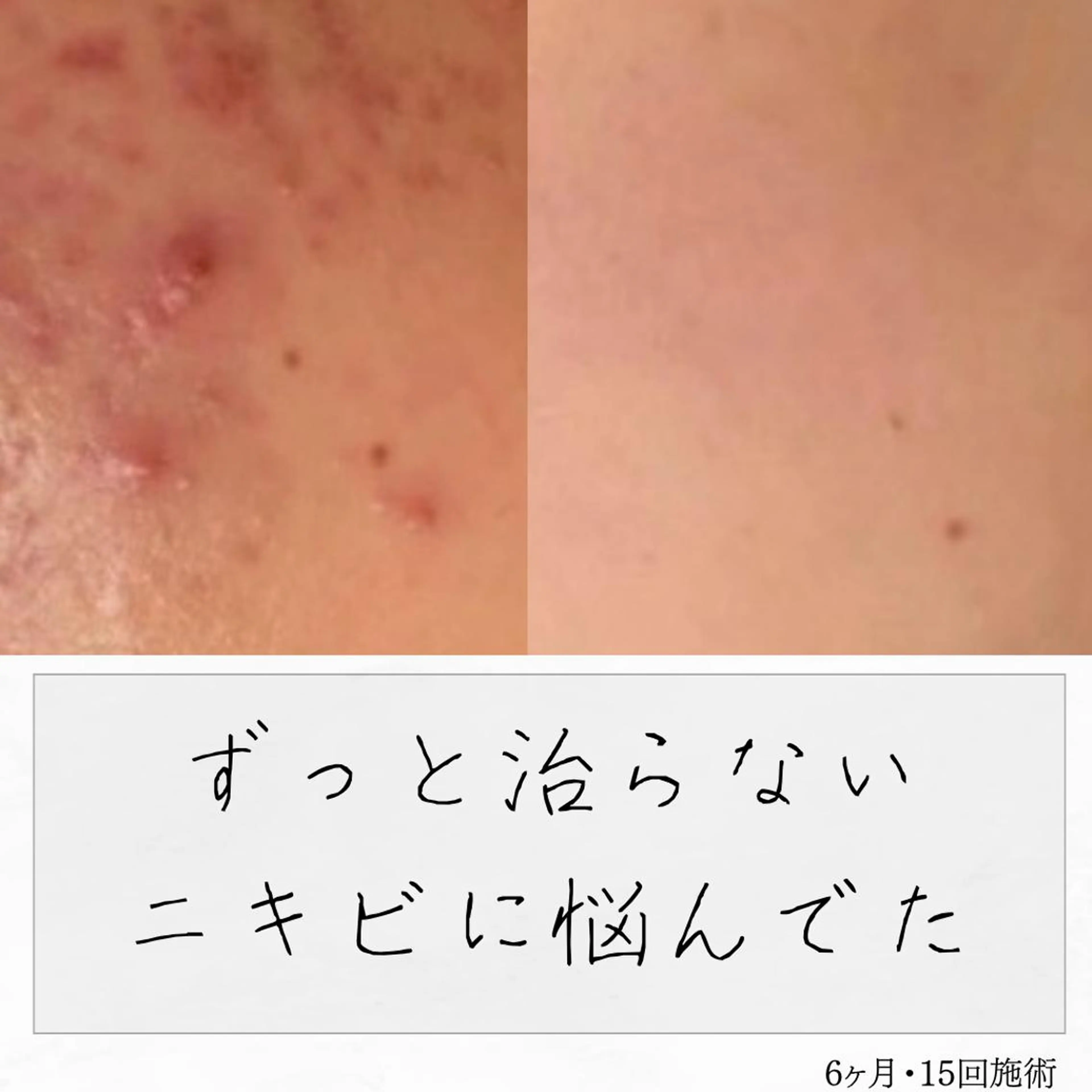 ニキビ経験者が施術 する専門サロン🌻のエステ・リラクイメージ