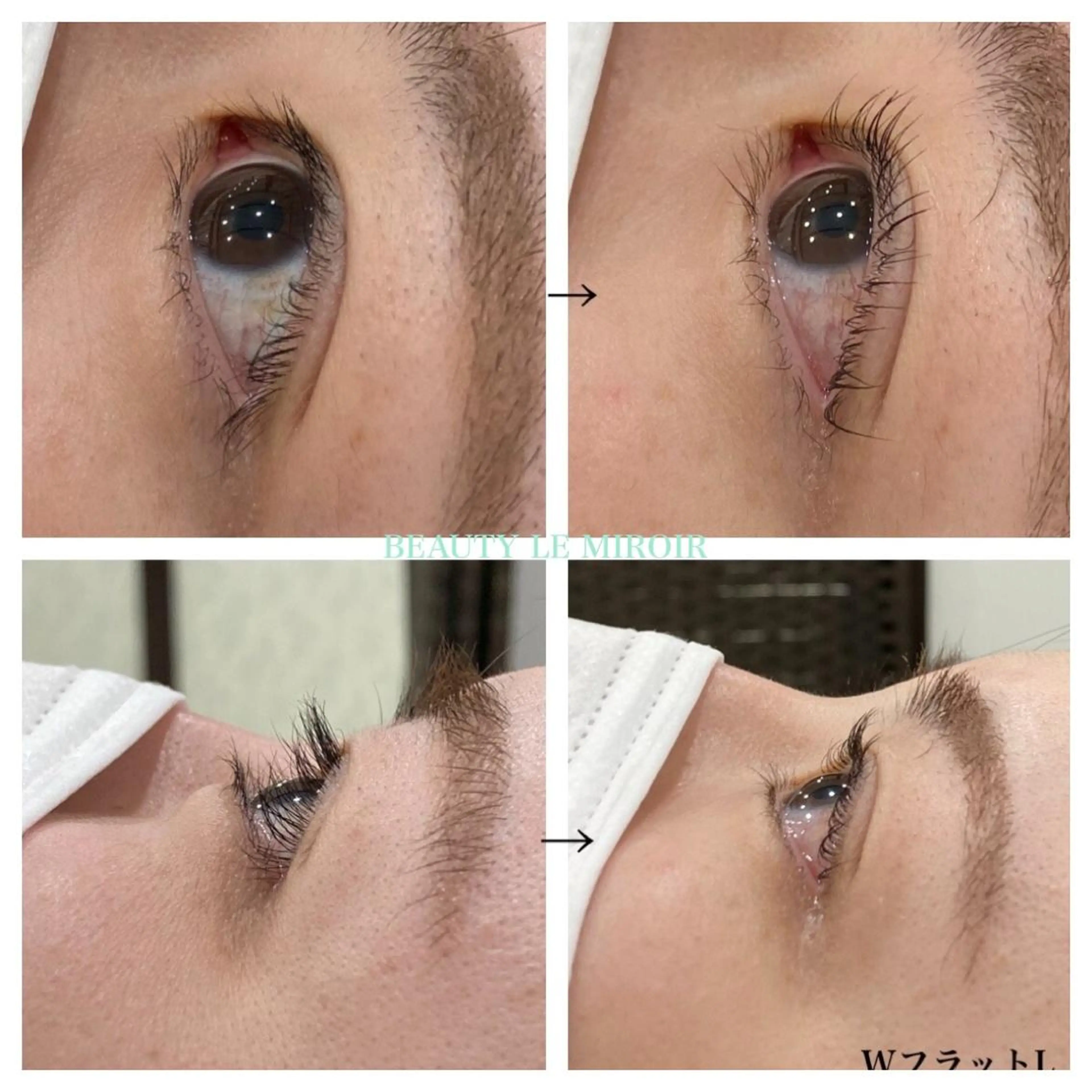 マツエク・マツパ ビューティー ミロワールのエステ・リラクイメージ