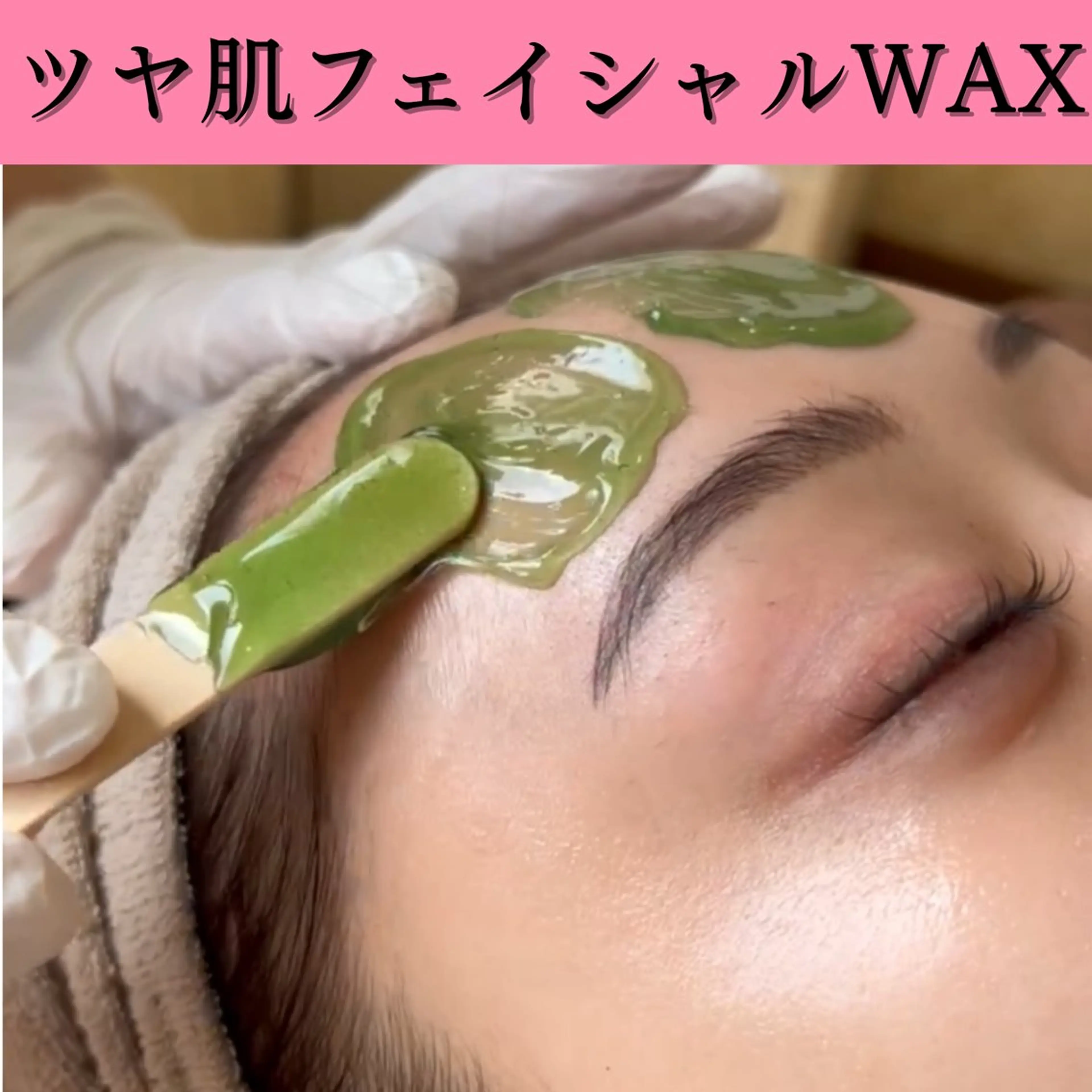 輝くうるツヤ肌へ💎【顔ワックス脱毛💆‍♀️】産毛&ムダ毛をその日のうちにツルツルに✨化粧ノリUP💄の写真