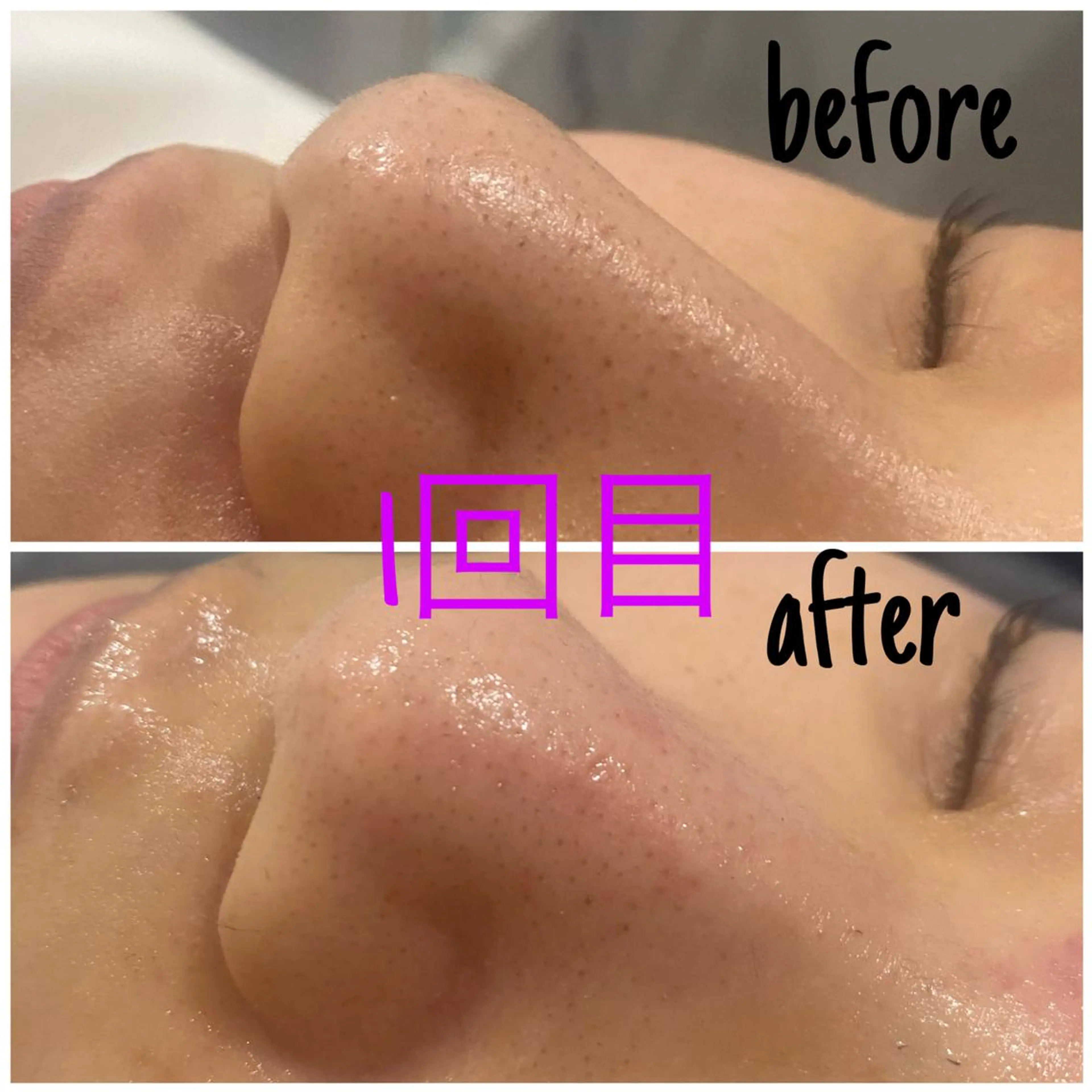 エステ 毛穴洗浄・痩身・脱毛 /アルカンジュのエステ・リラクイメージ