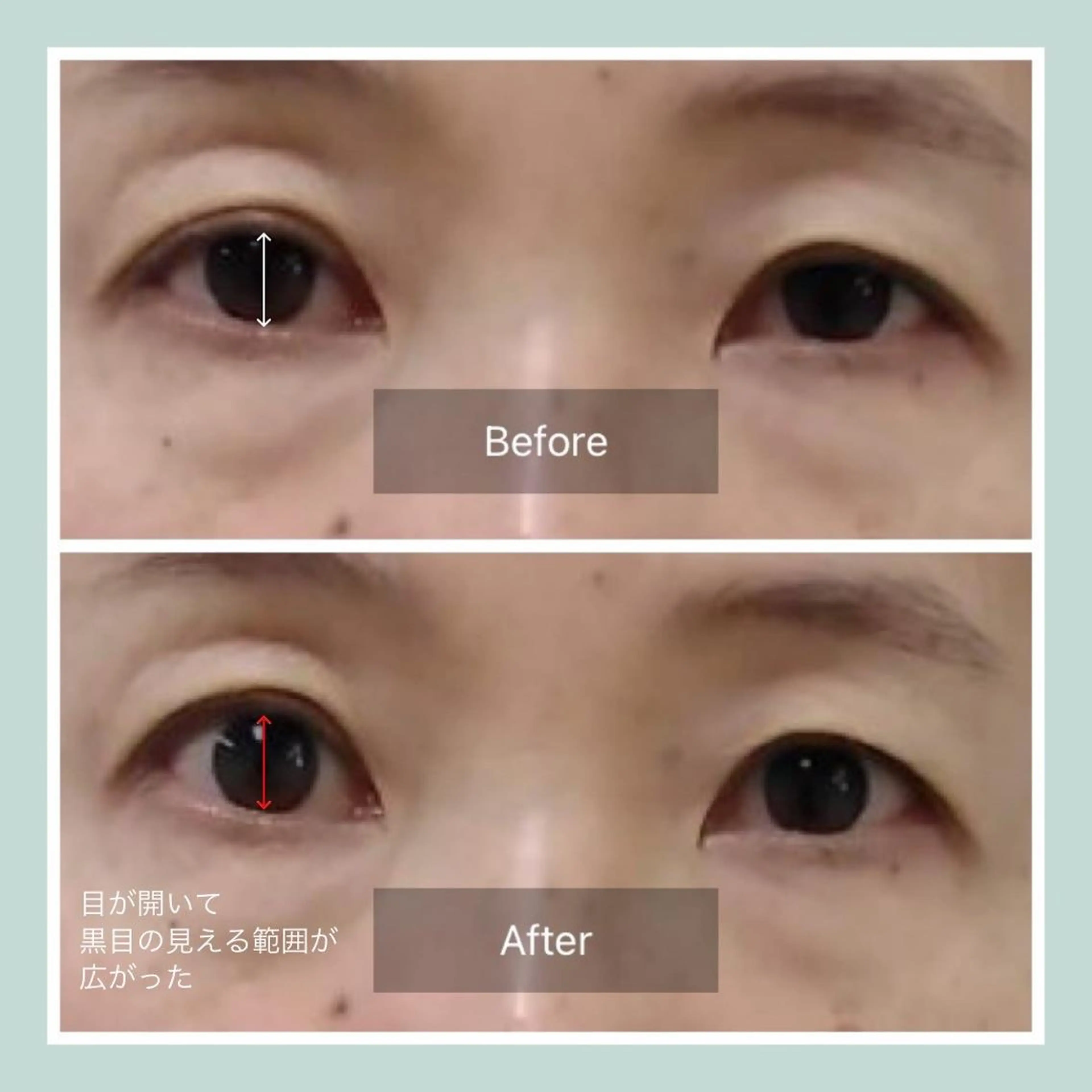 韓国/ヌーディー系 ネイル自由が丘のネイルデザイン