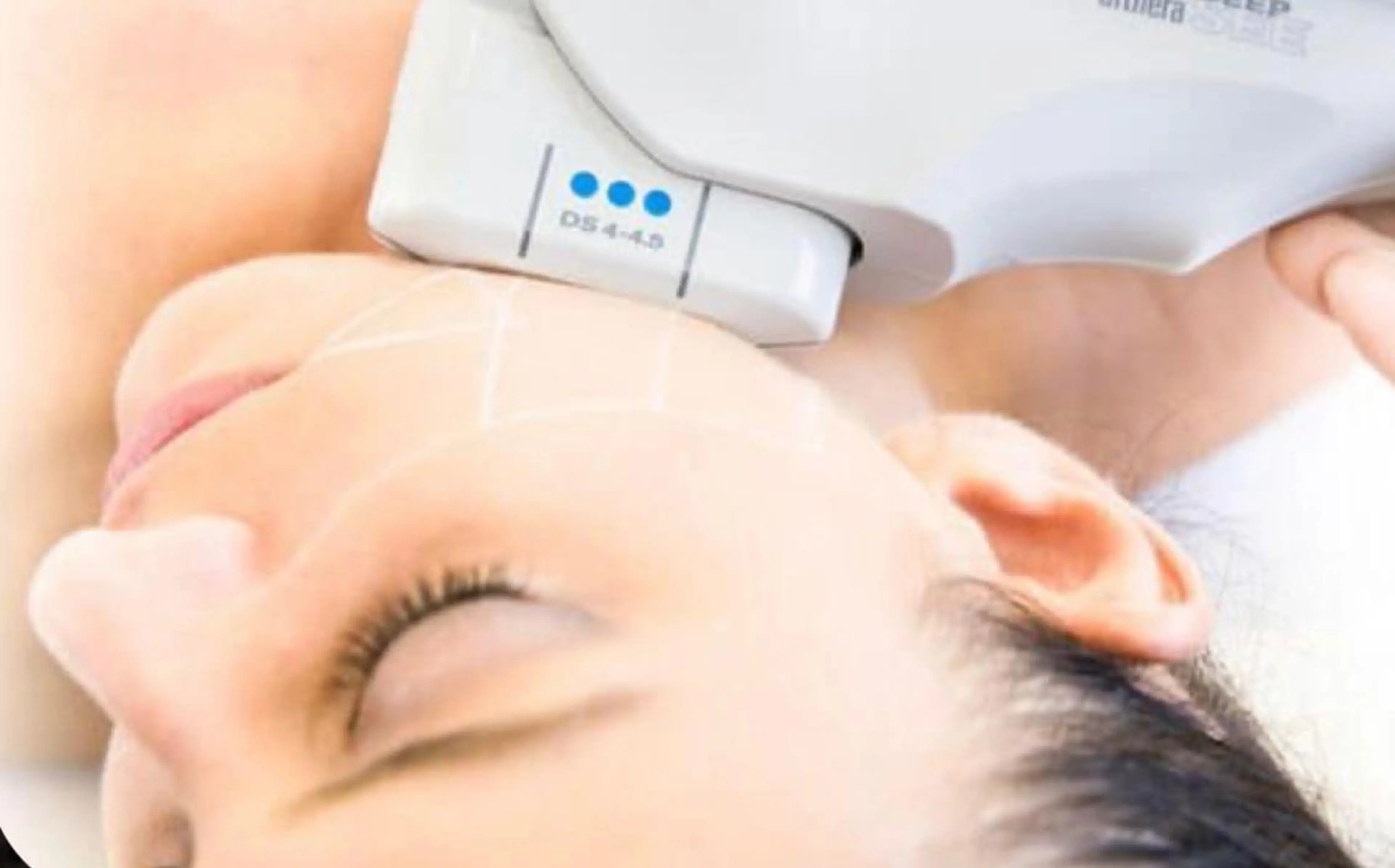 🪩ハーブピーリング & 小顔8000ショット🪩の写真