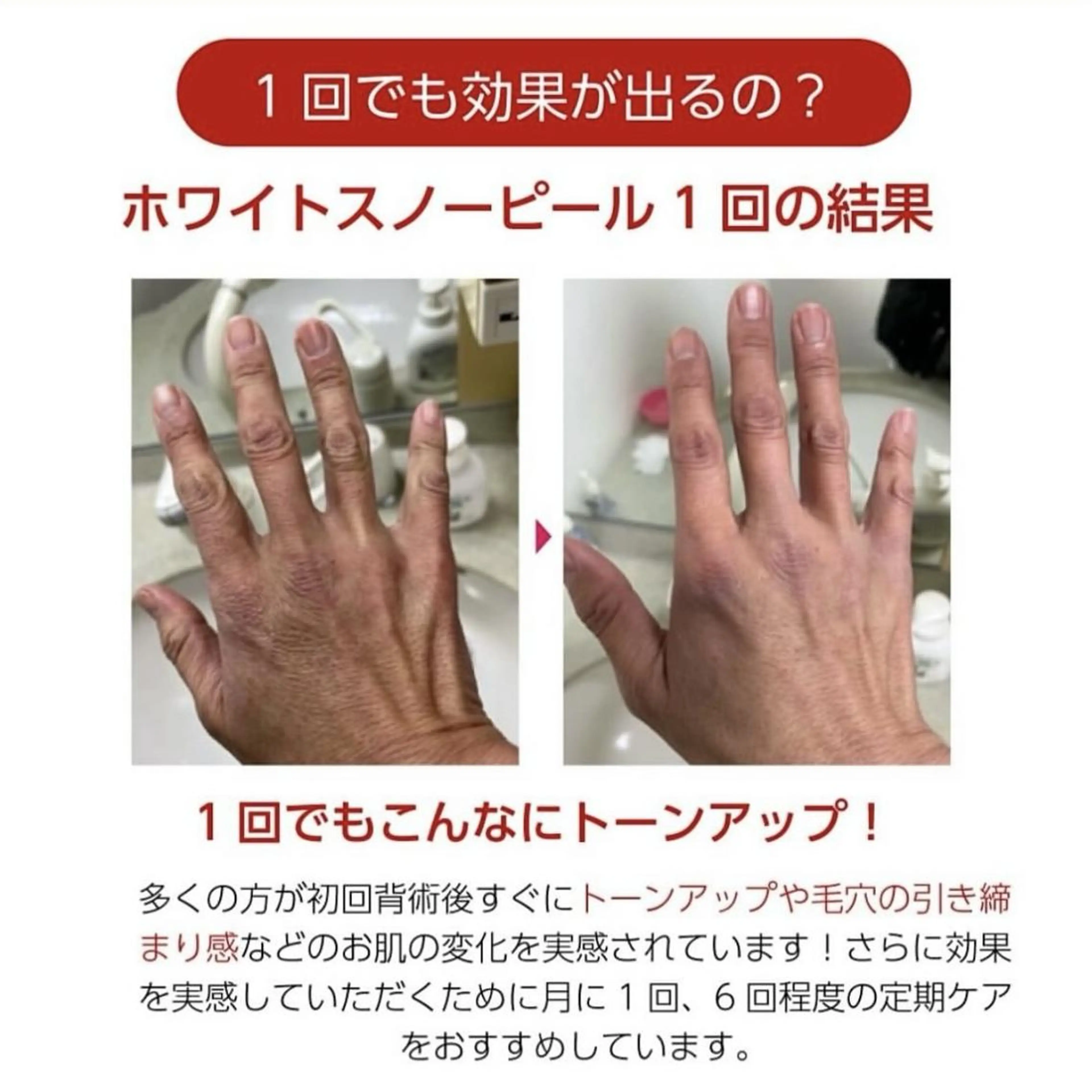 RinRin 山口店のエステ・リラクイメージ