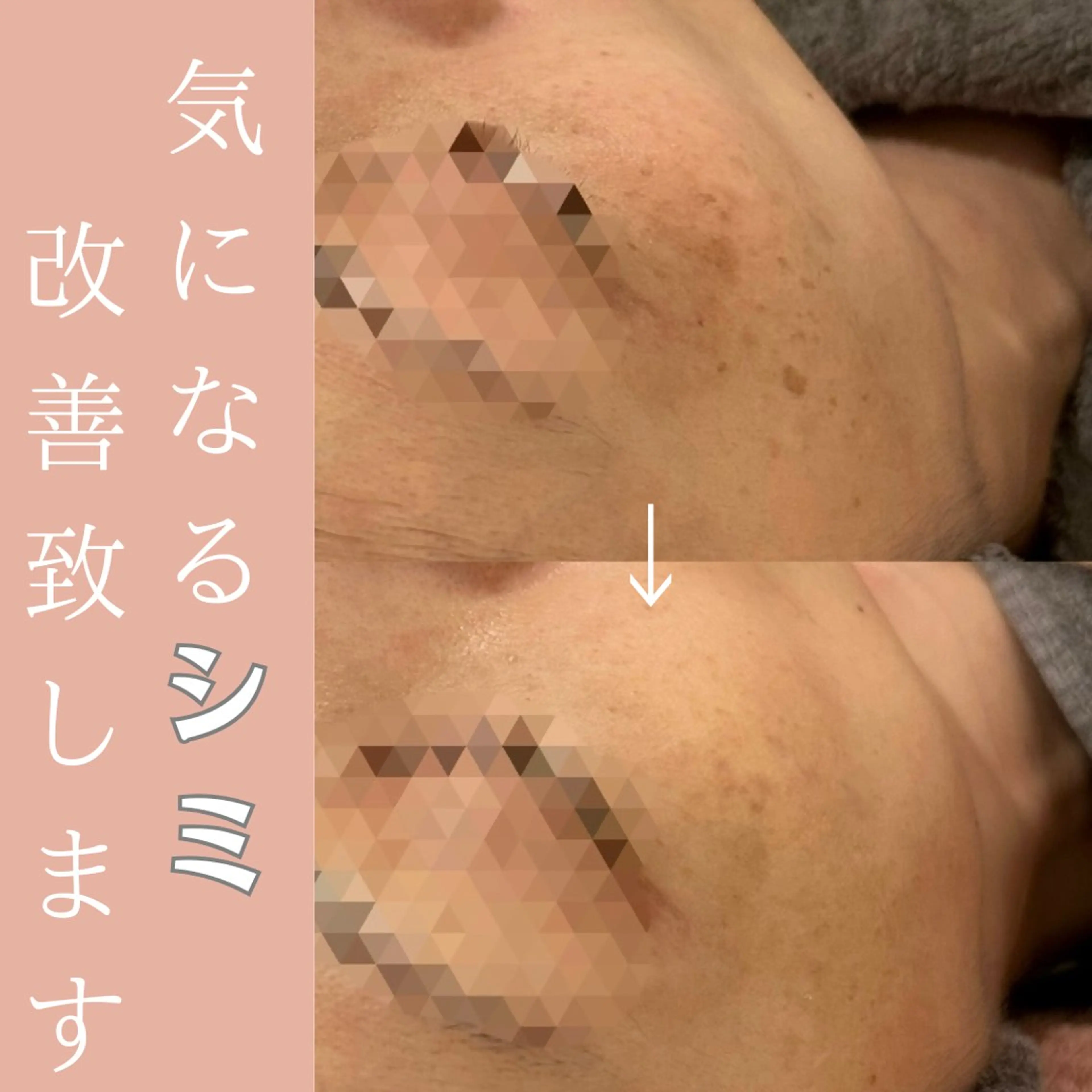 ラシュシュ 茨木のエステ・リラクイメージ