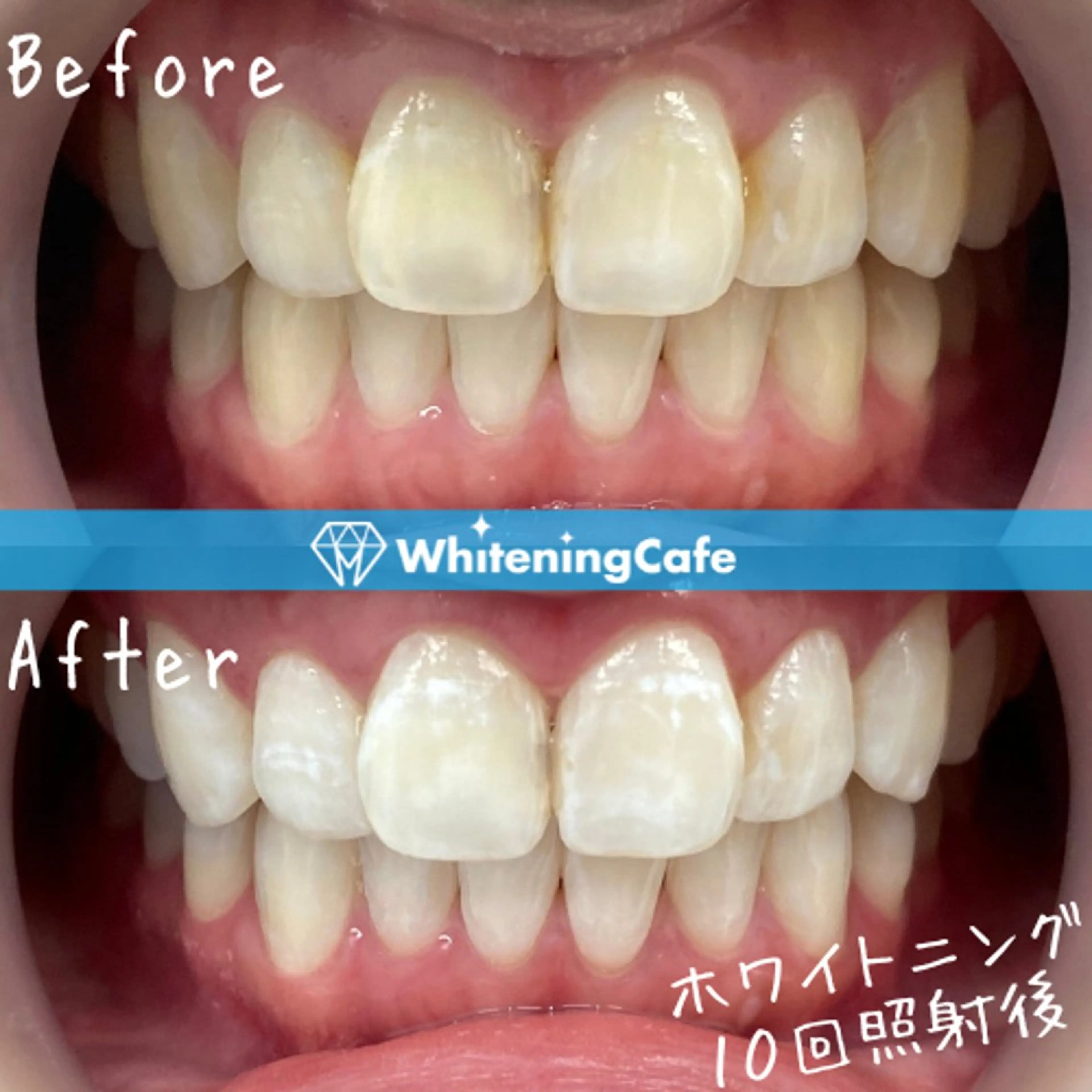 ホワイトニングカフェ 神戸元町店のエステ・リラクイメージ