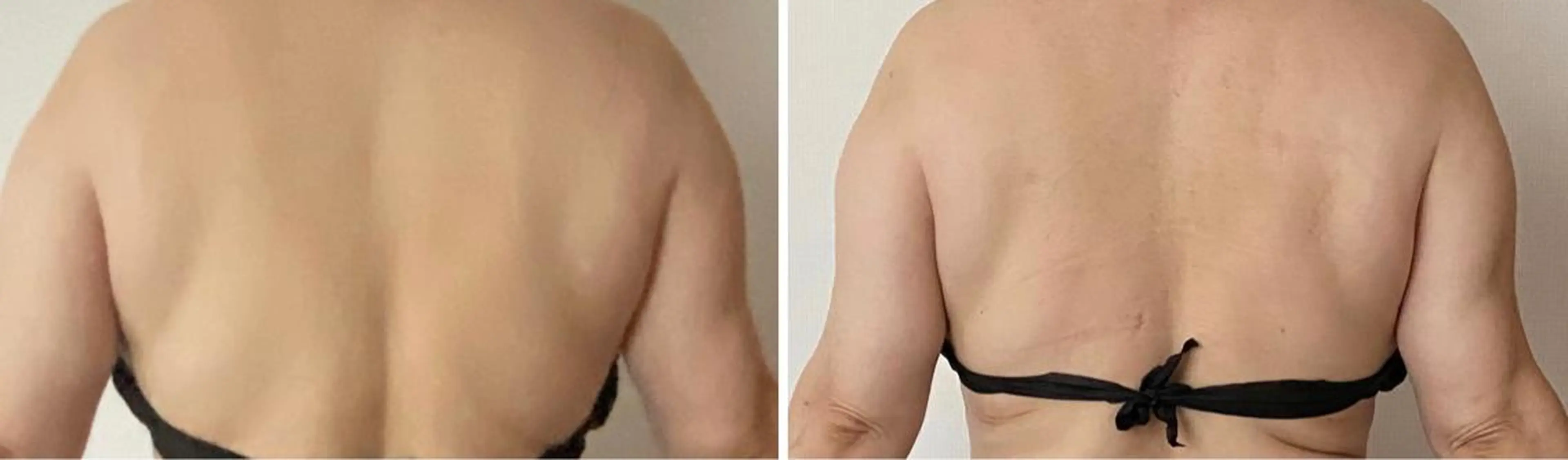 朝重い人専用 肩甲骨調整のエステ・リラクイメージ