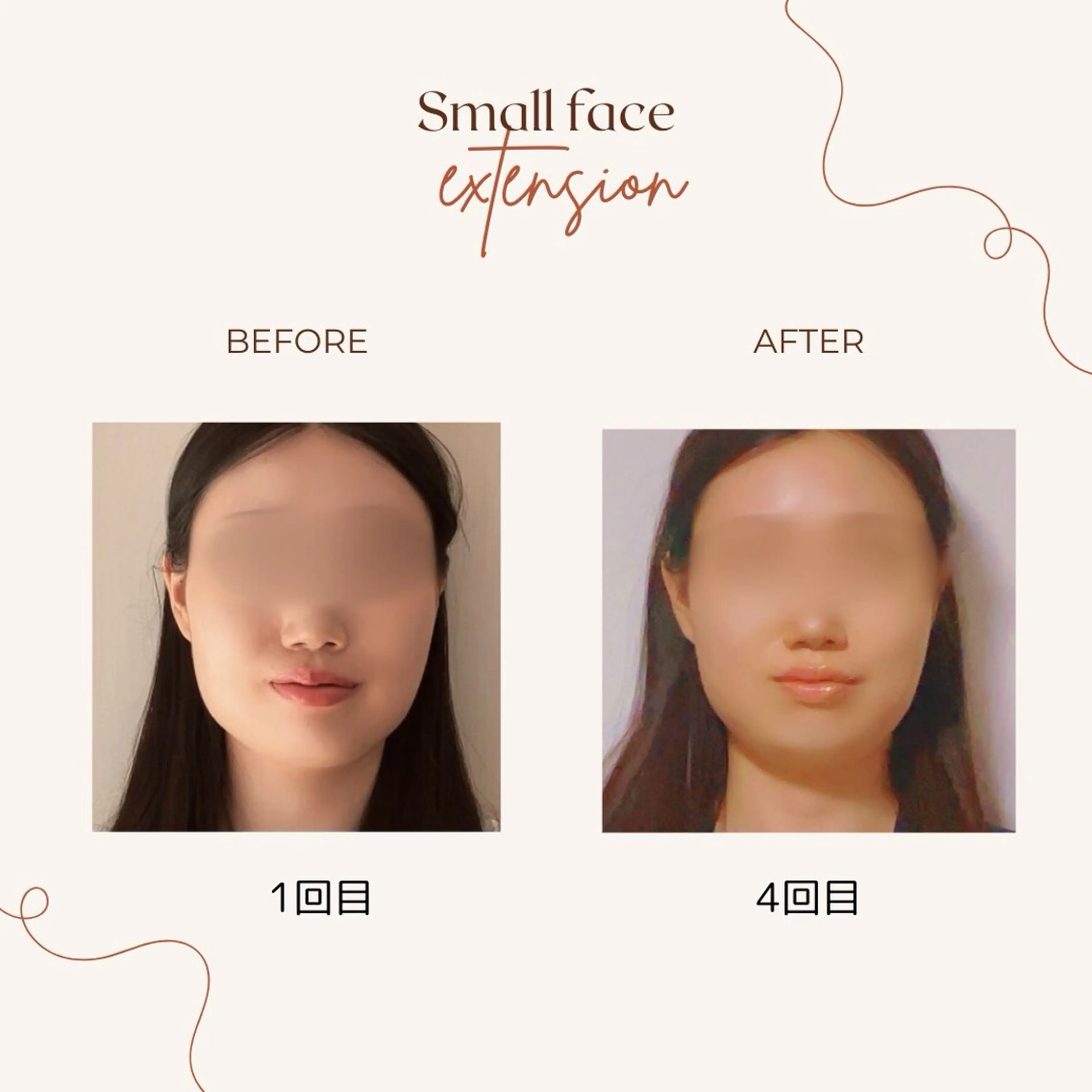 リラク 肩こり・腰痛改善専門 1万人以上施術の碧人のエステ・リラクイメージ