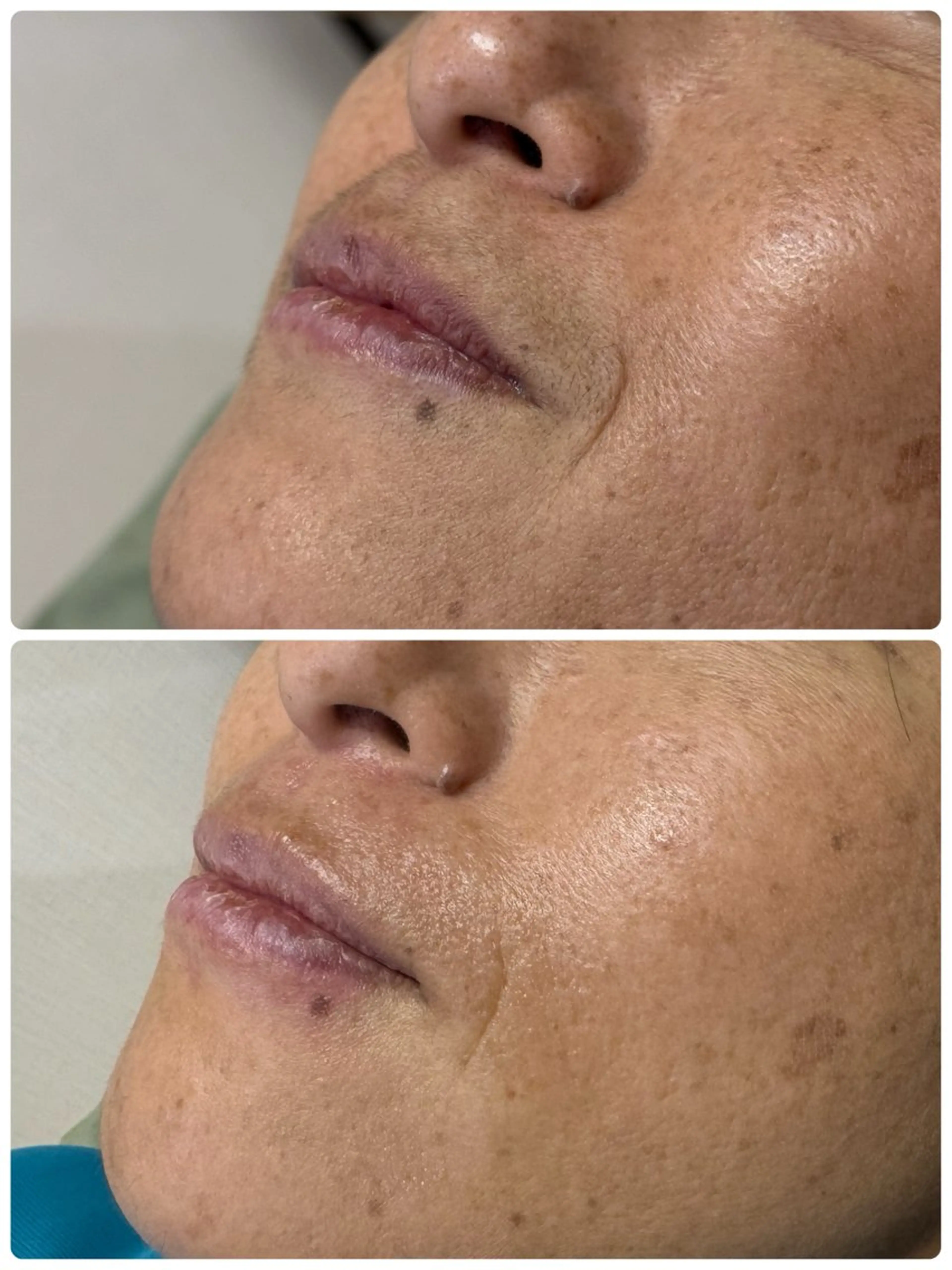 Hallbar佐賀店 山下の眉毛・アイブロウイメージ