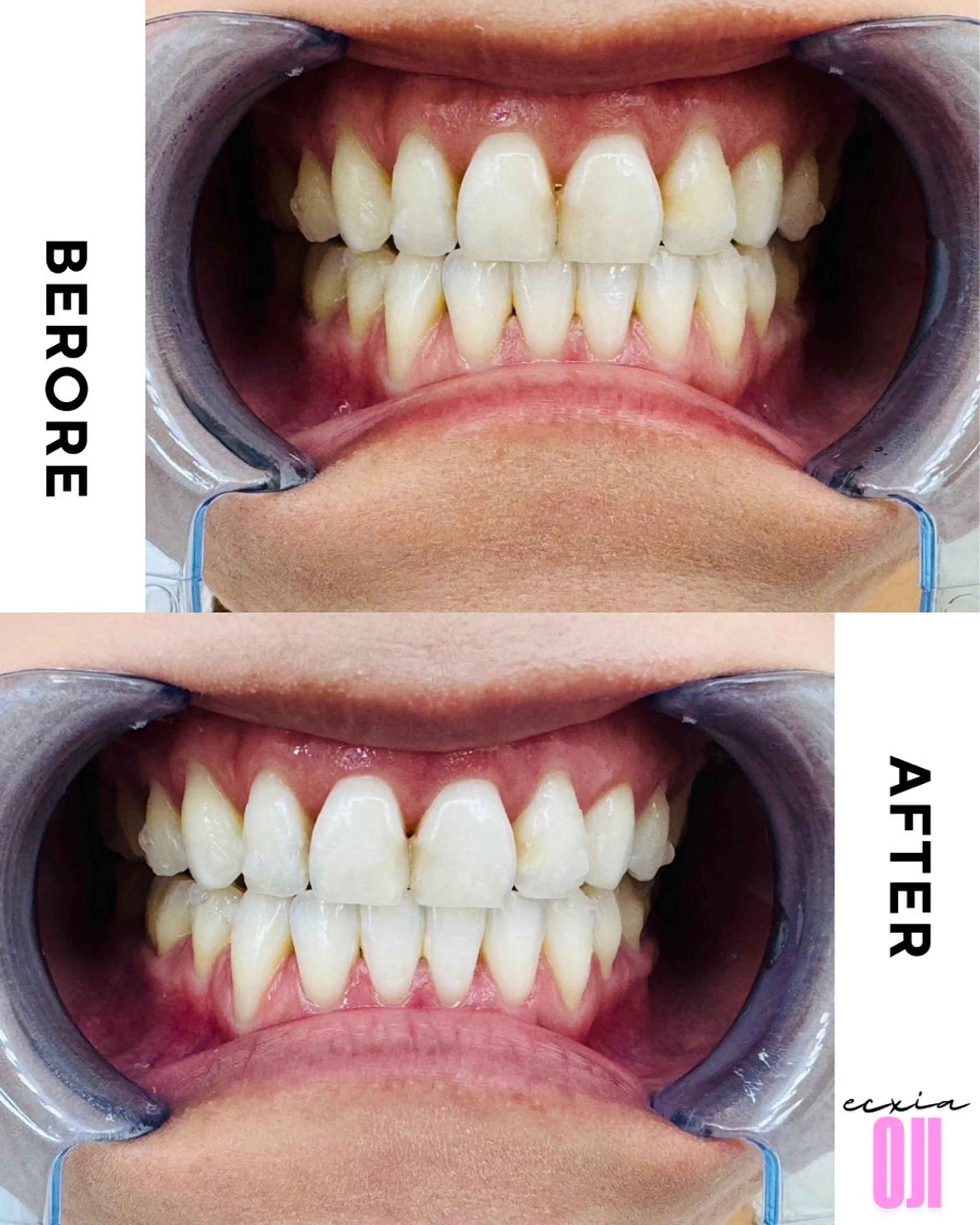 その他 セルフホワイトニングサロン  エクシアホワイト 王寺店所属・エクシア王寺 NISHIKAWAのその他イメージ