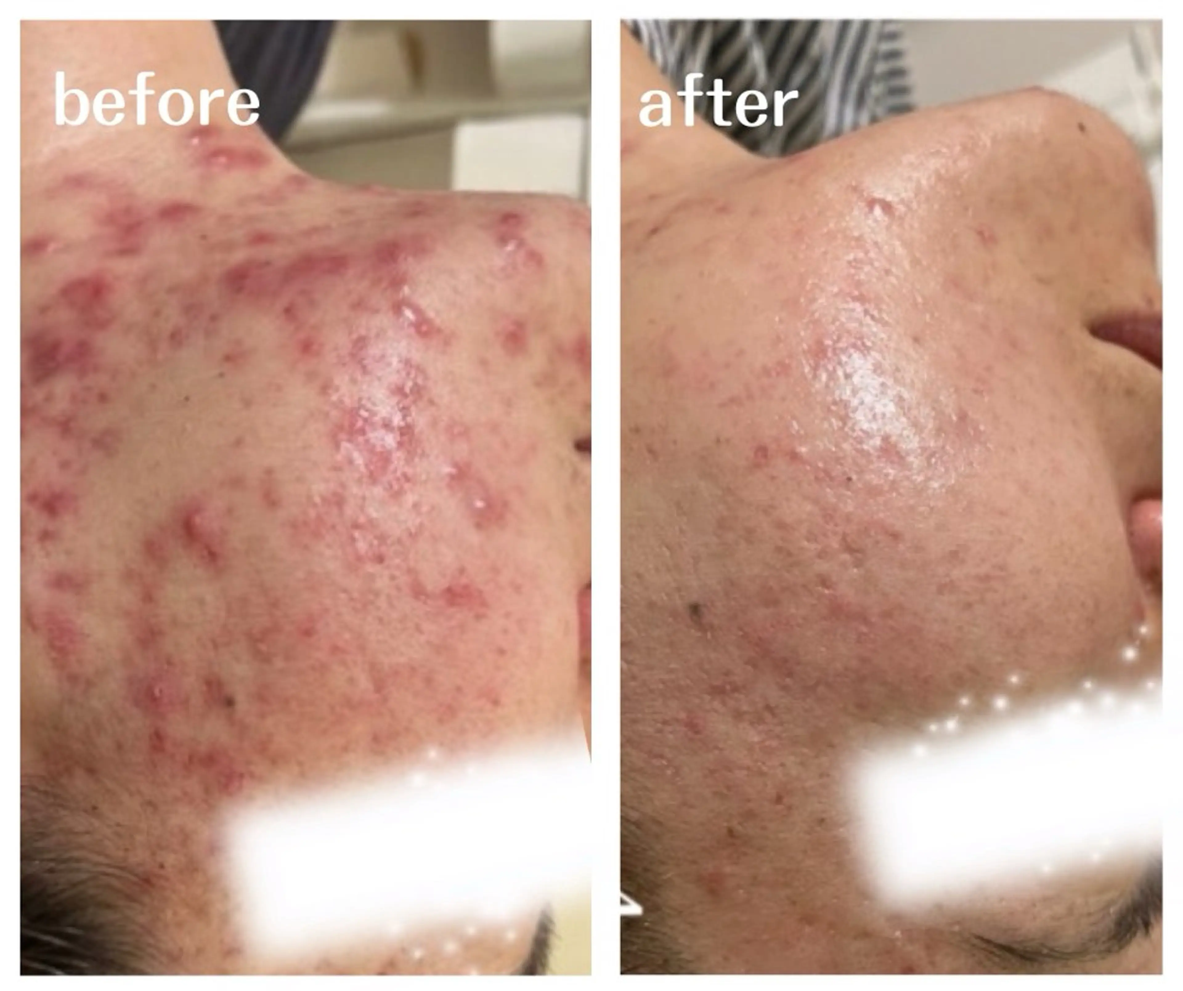 肌質改善サロン aimee｜アイミーのエステ・リラクイメージ