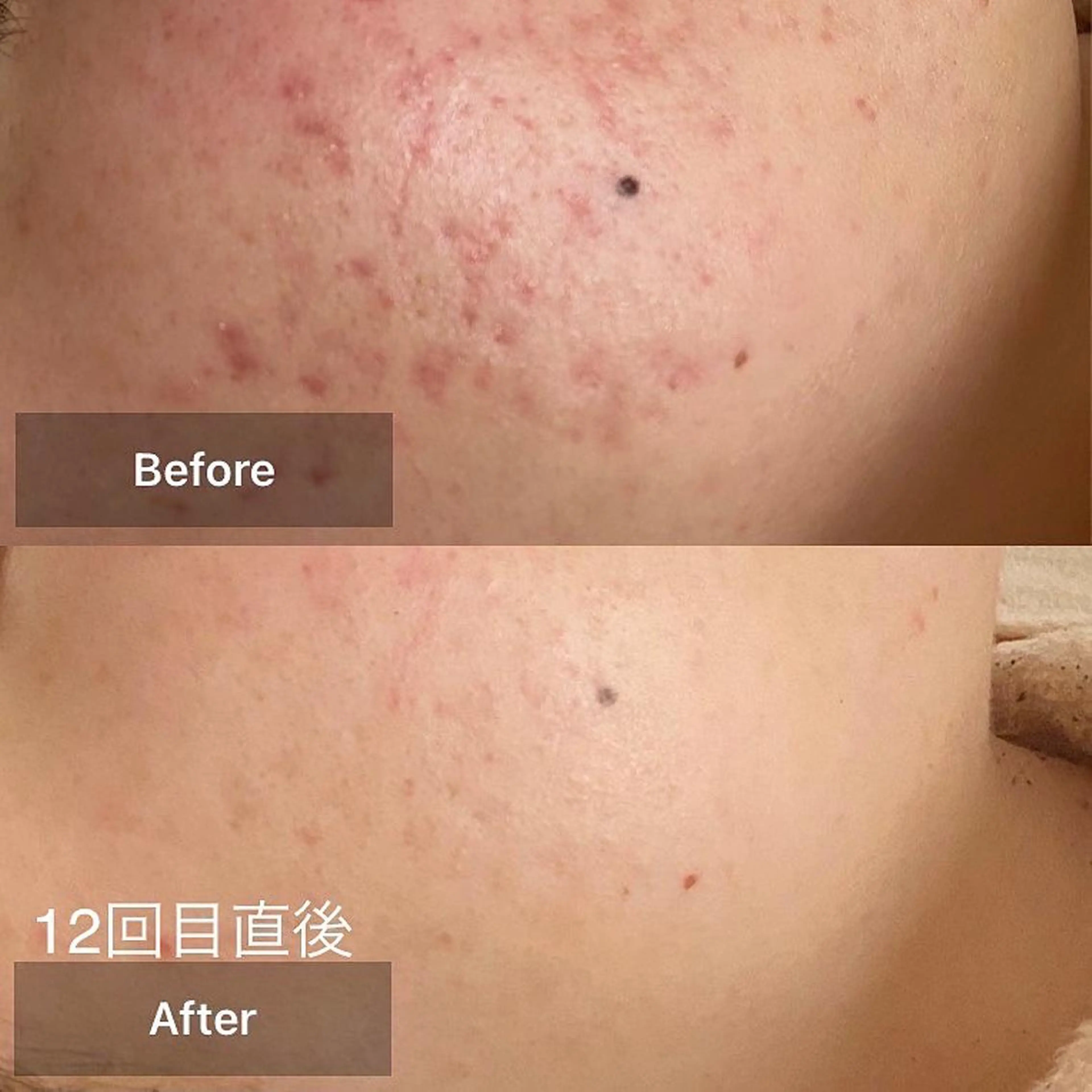 メンズ キッズ エステ 美肌・リラクゼーションサロンLu,Mie所属・美肌と癒しのサロン Lu,Mieのエステ・リラクイメージ