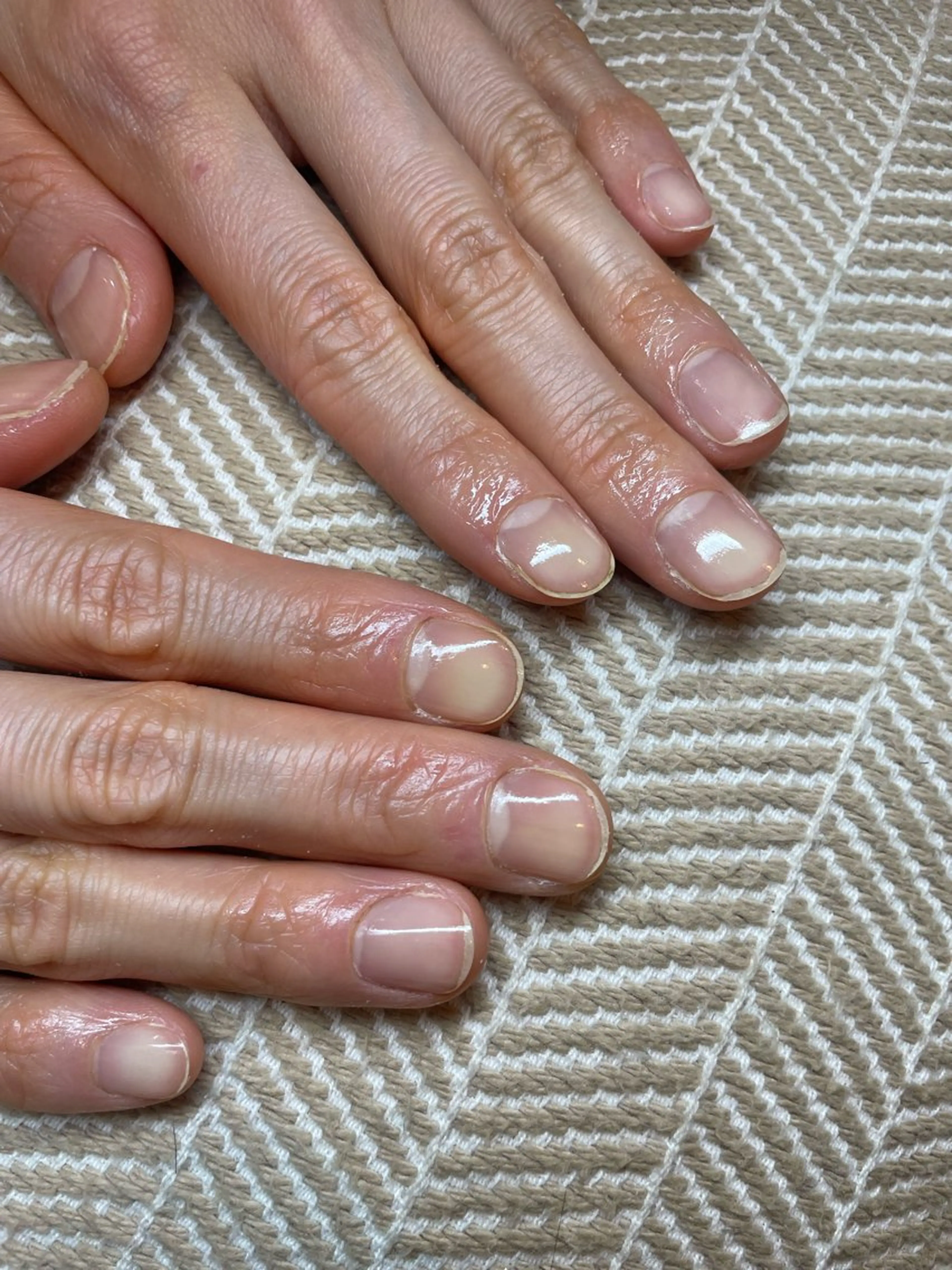 【ハンドケア】の写真