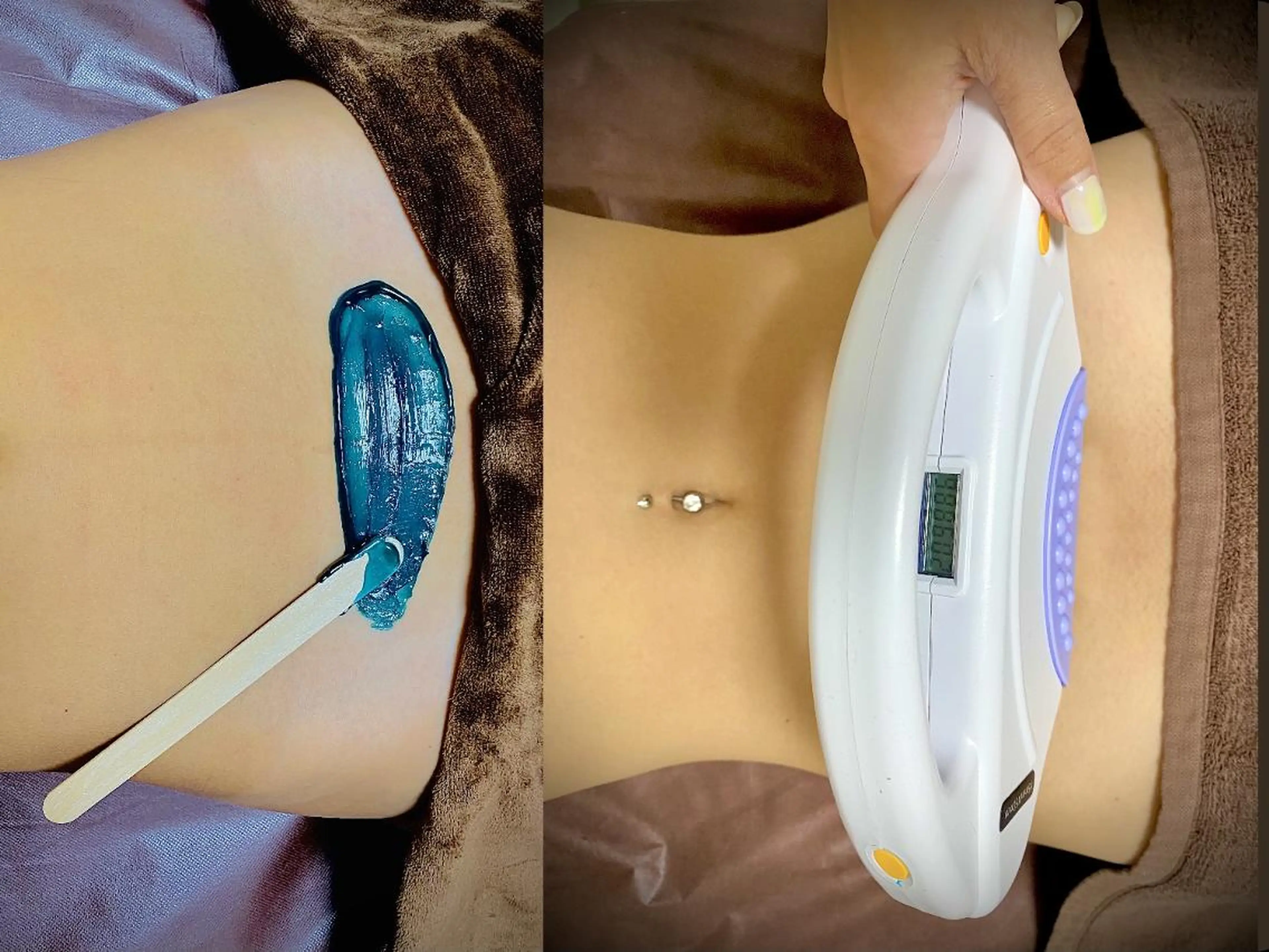 キッズ メンズ 脱毛 Epina 千葉店 【エピナ】のエステ・リラクイメージ