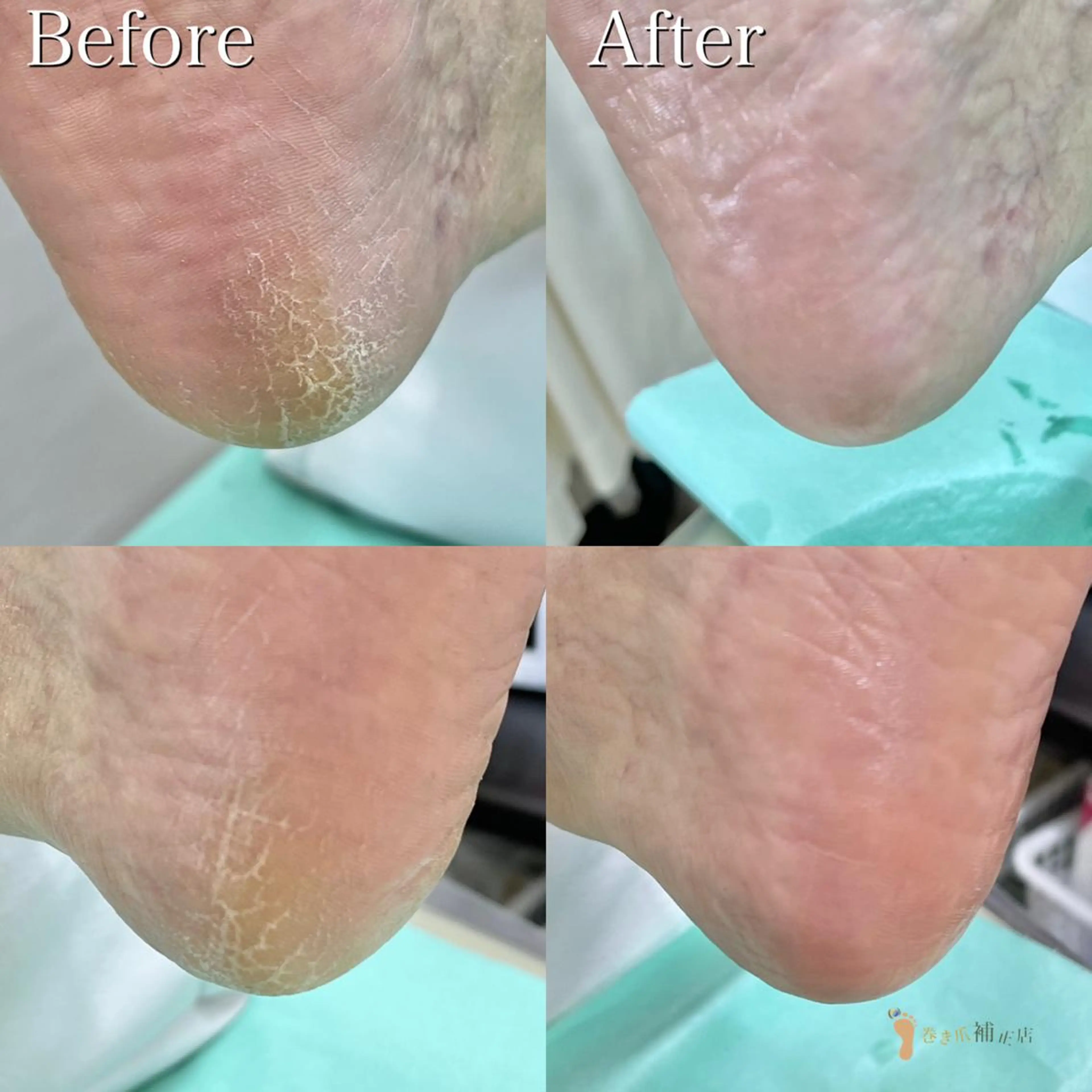 東京巻き爪 アカデミーのエステ・リラクイメージ