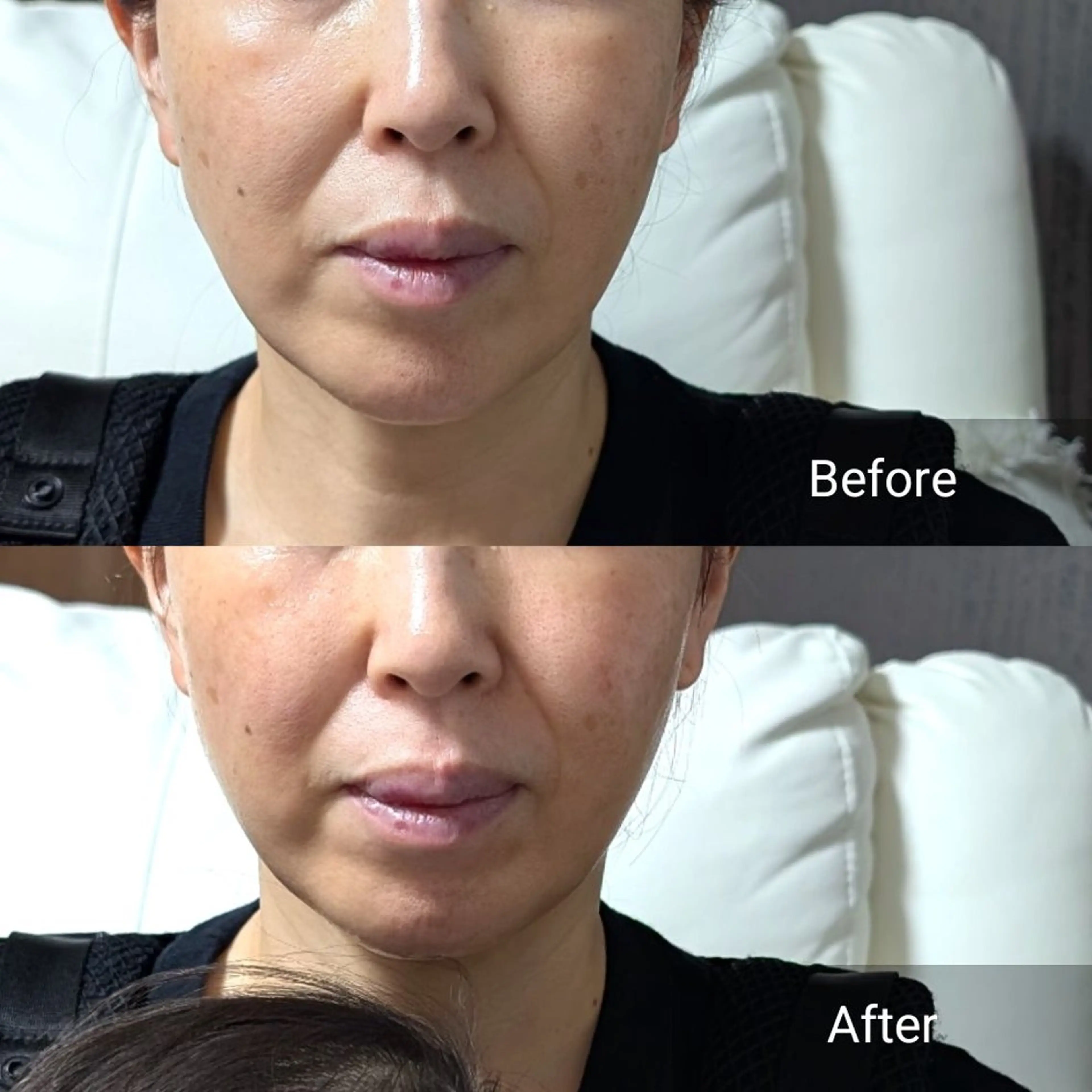 エステ nail RiRi アトレナチュラのエステ・リラクイメージ