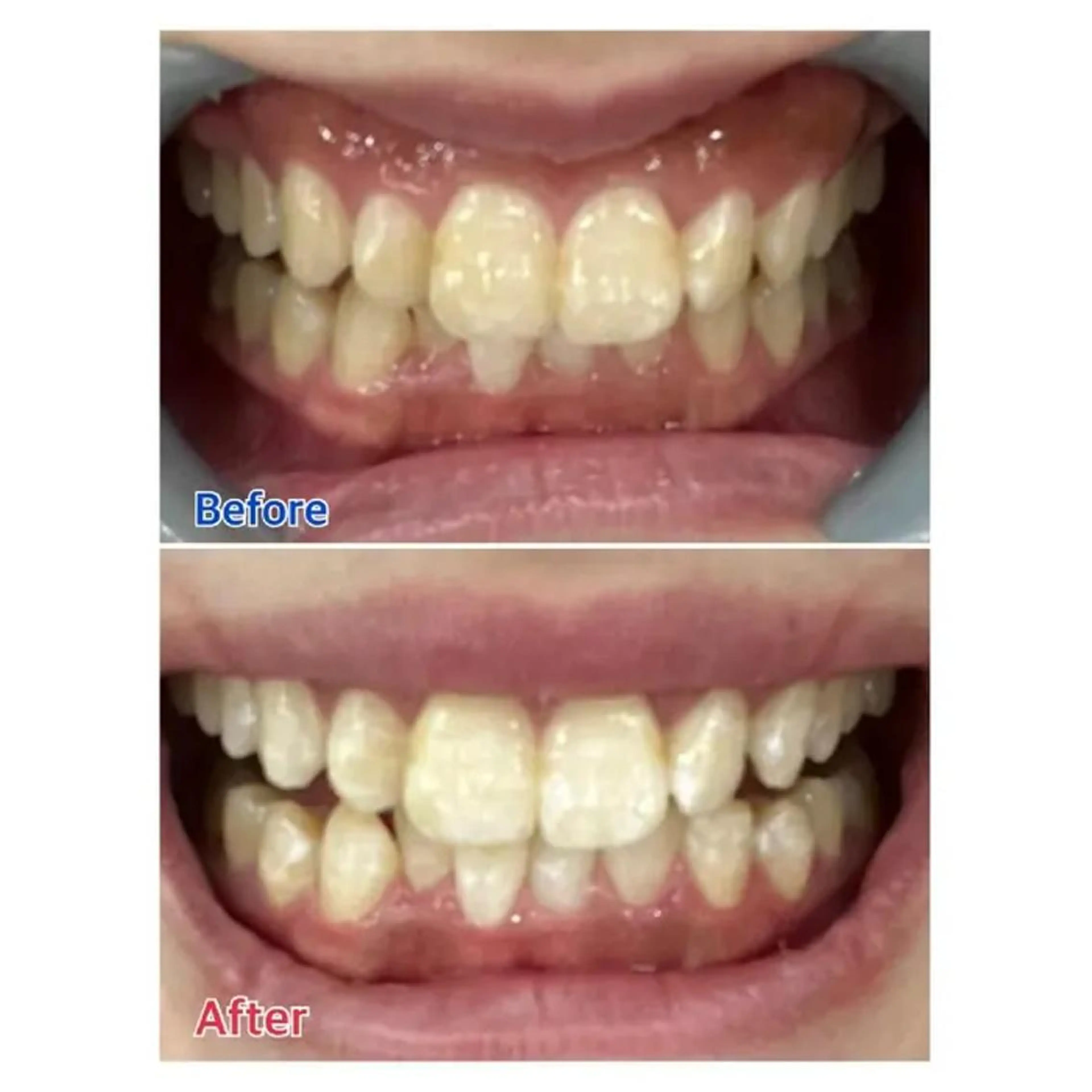 M渋谷 ホワイトニングのその他イメージ