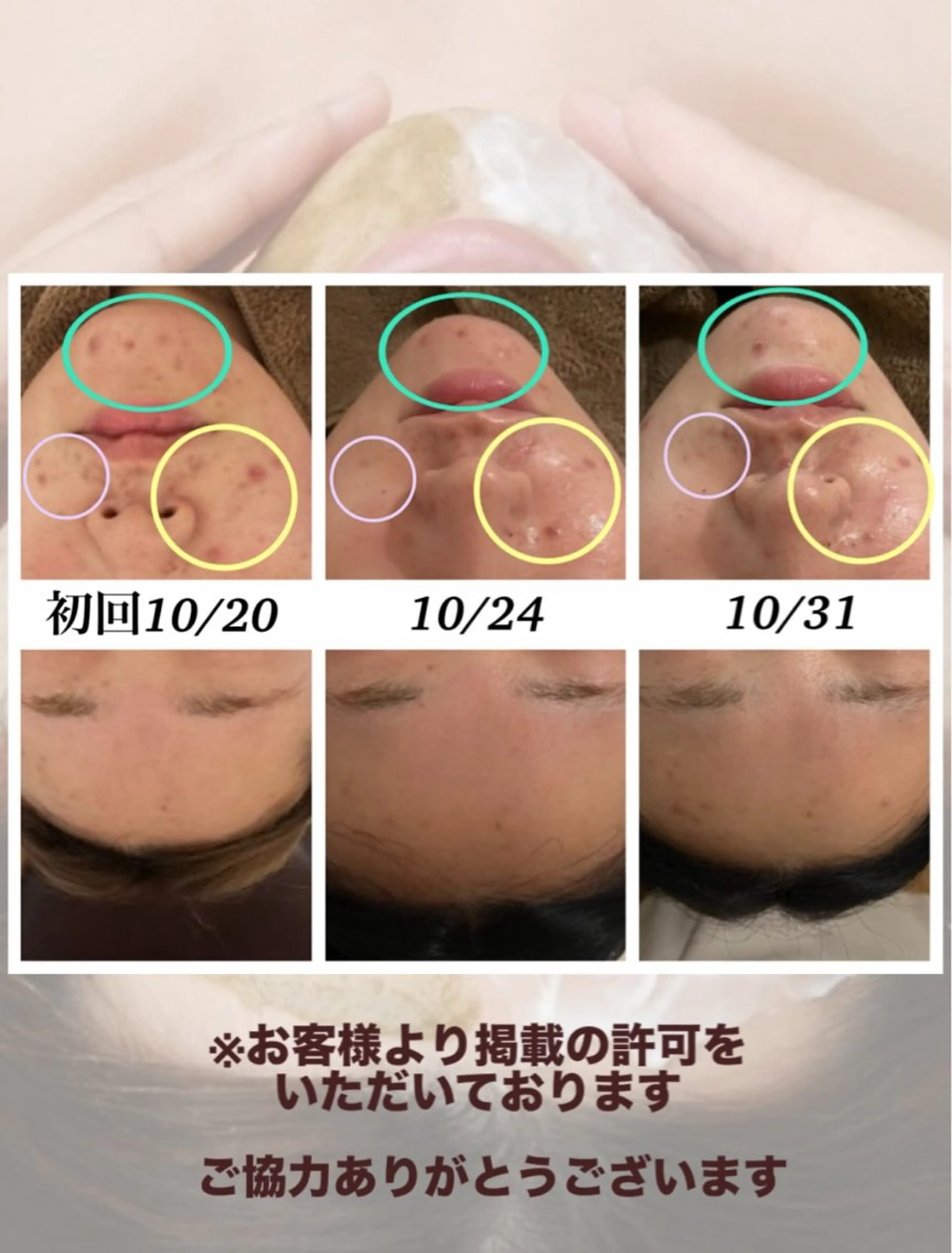 ベルーテ エッセンスのエステ・リラクイメージ